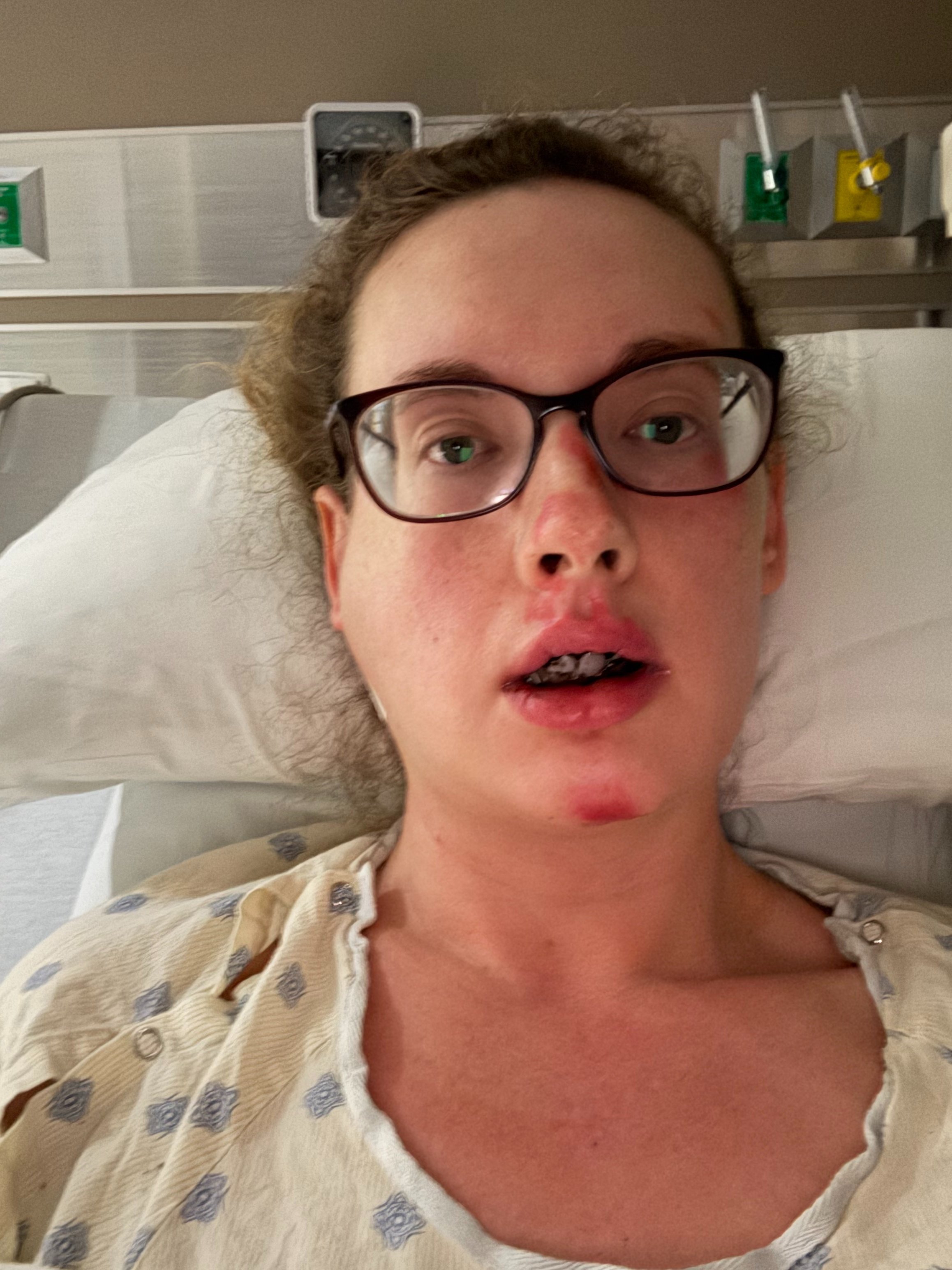 Help Blair Get Her Smile Back After Crash campaign photo, 2 of 8