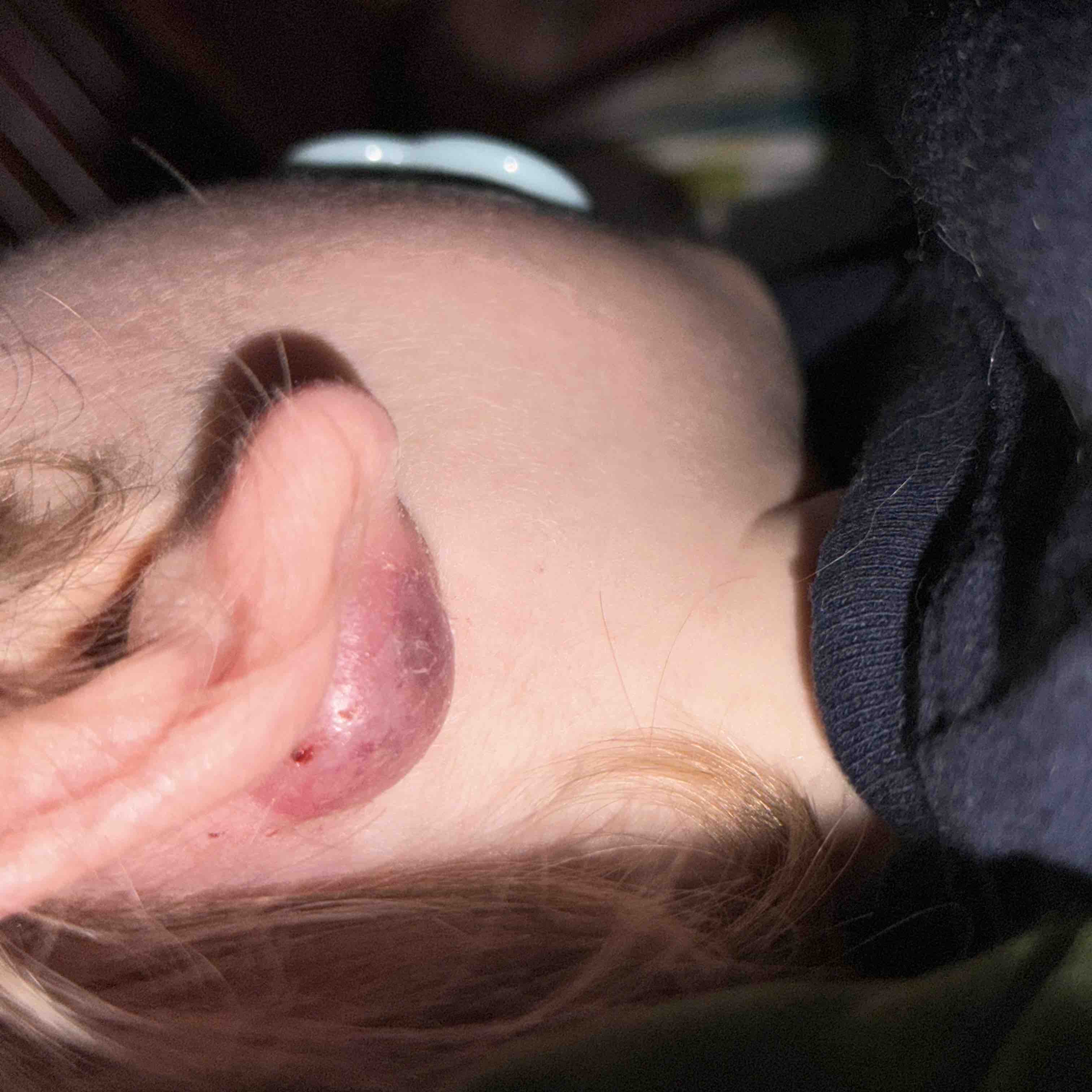 Support for Elijah’s major surgery and recovery  campaign photo, 9 of 10