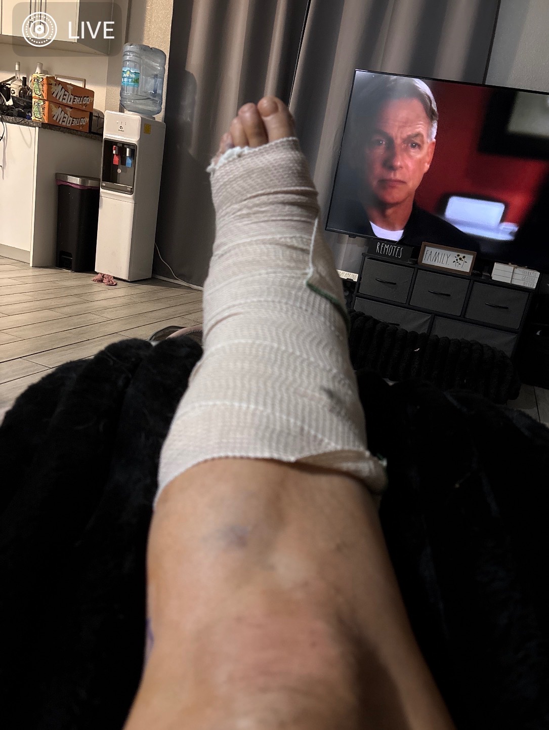 Urgent Aid for Robin’s Next Surgery and Recovery campaign photo, 4 of 5
