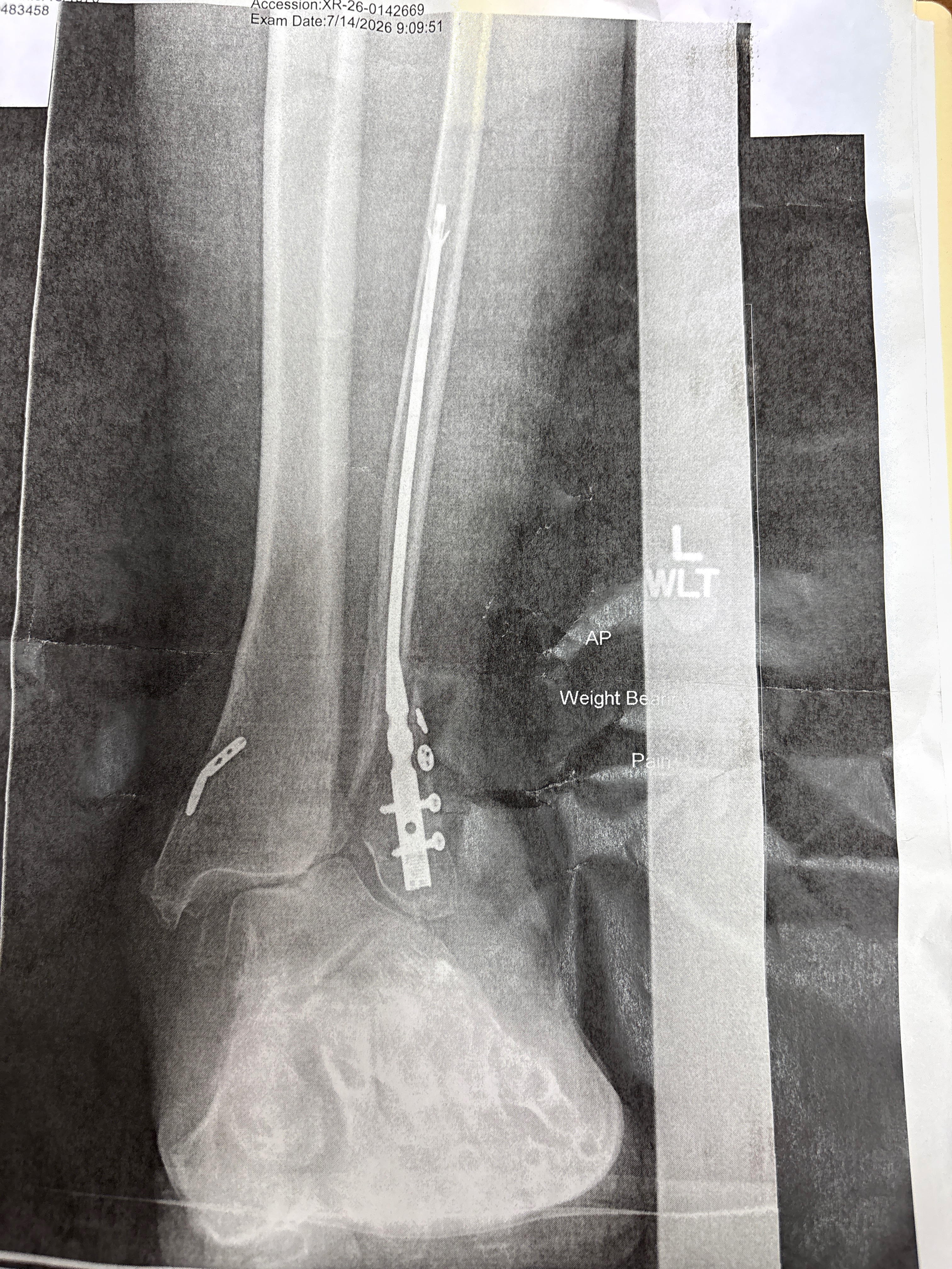 Urgent Aid for Robin’s Next Surgery and Recovery campaign photo, 2 of 5