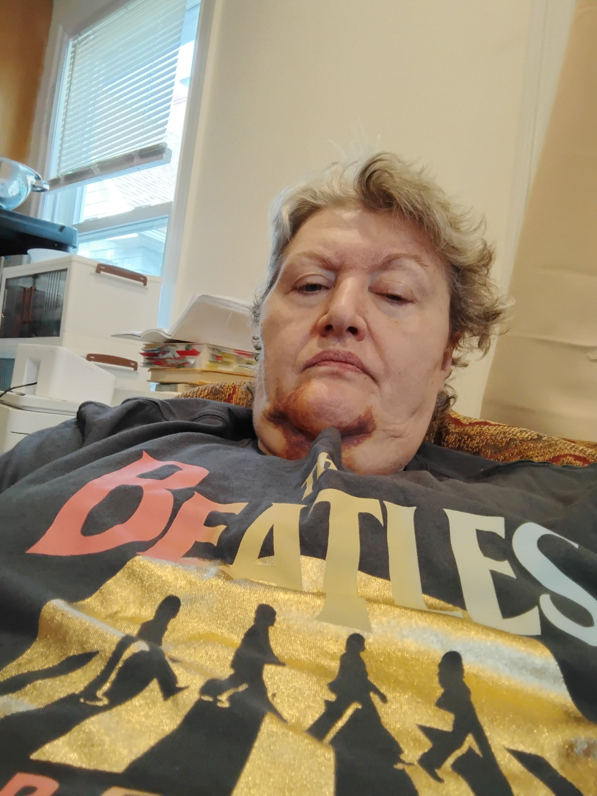 Laughing Through Pain: Support Through Worsening disability campaign photo, 4 of 8