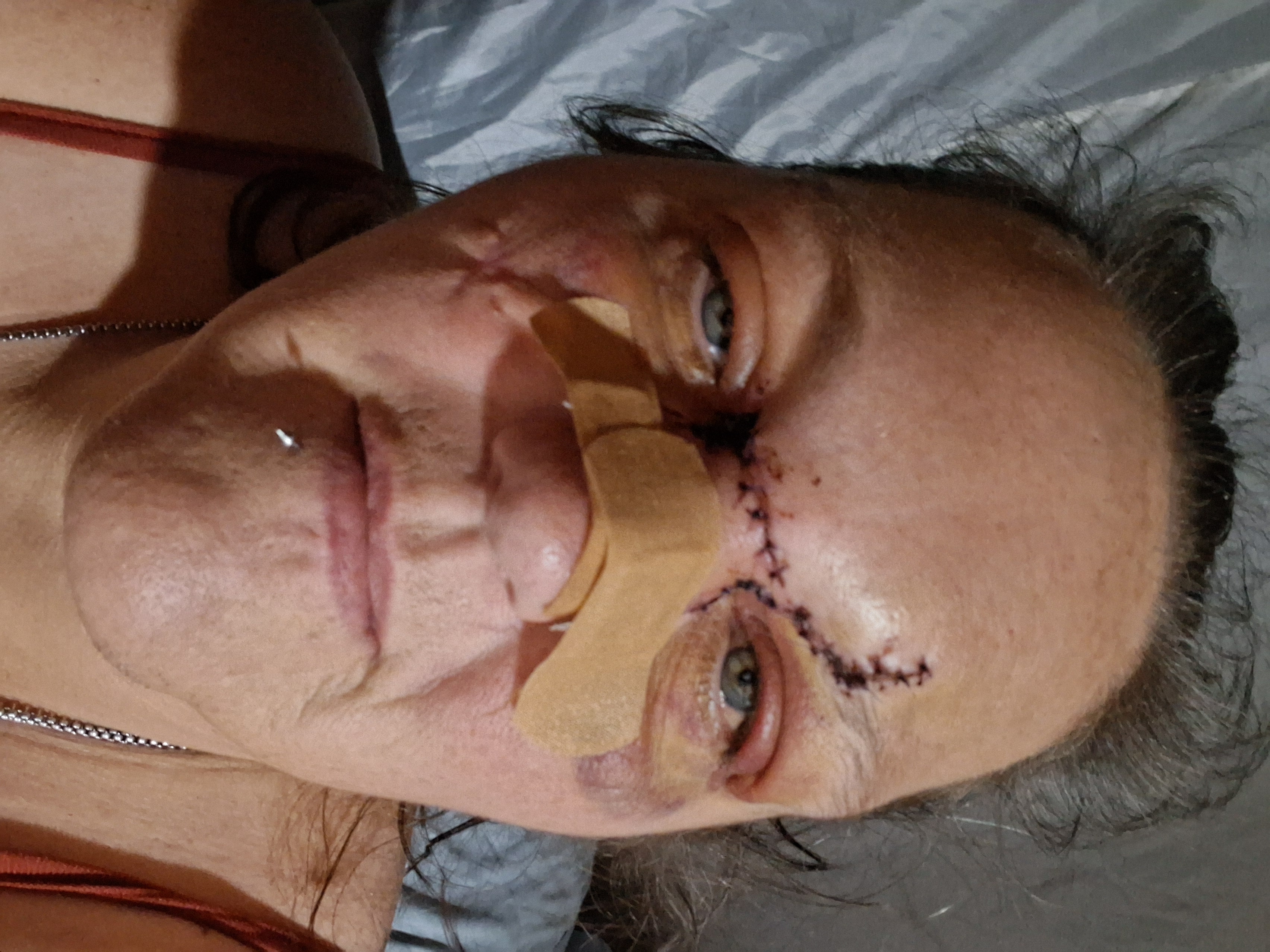 Help janet in this time of emergency campaign photo, 9 of 10