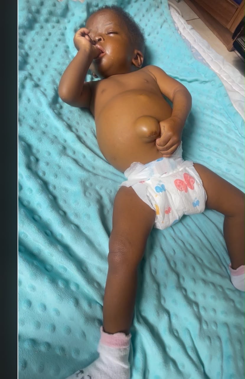 Help Naomi Get a Life-Saving Liver Transplant campaign photo, 7 of 8