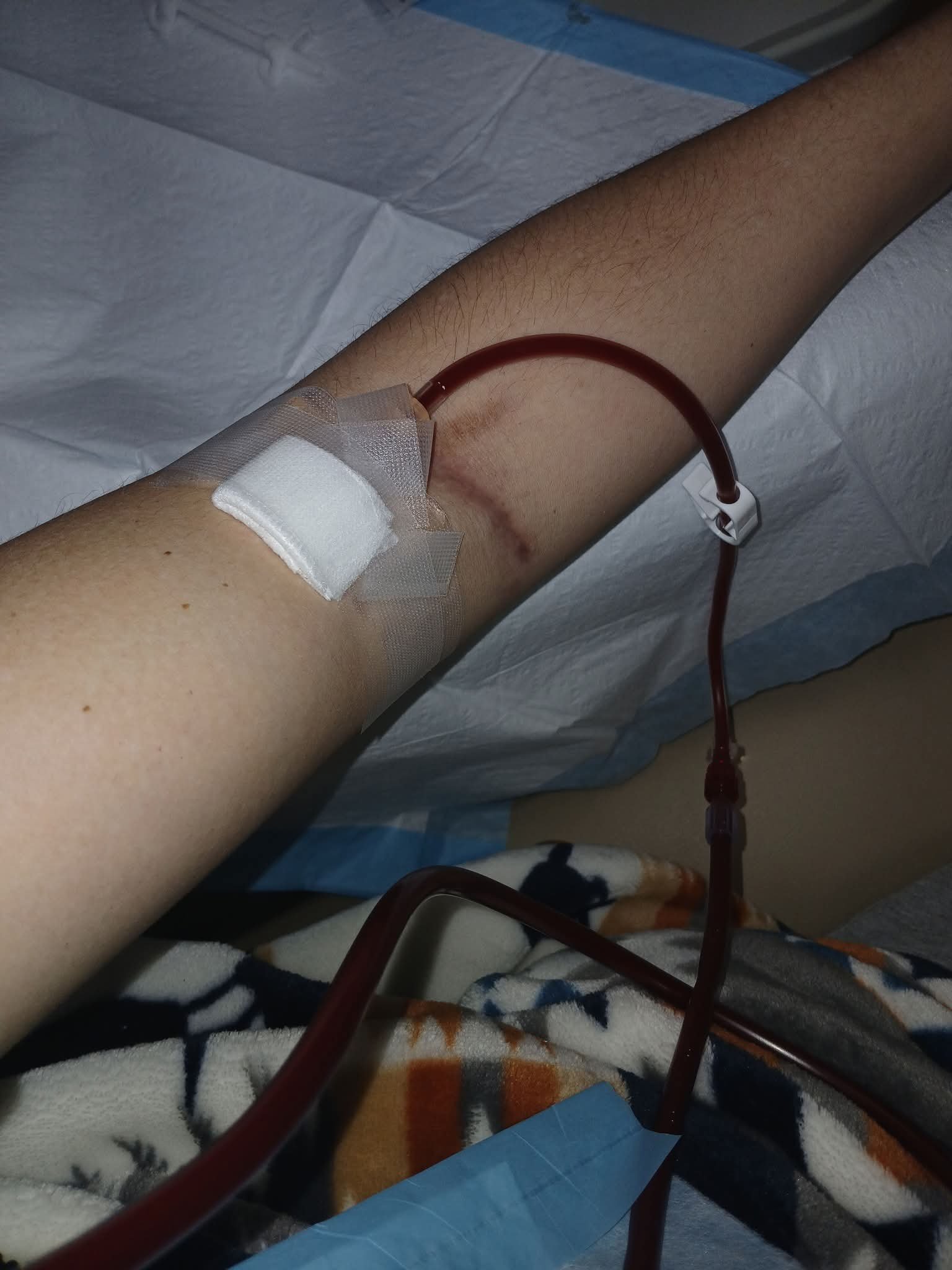 Support Azaria’s Kidney Failure Journey campaign photo, 2 of 7