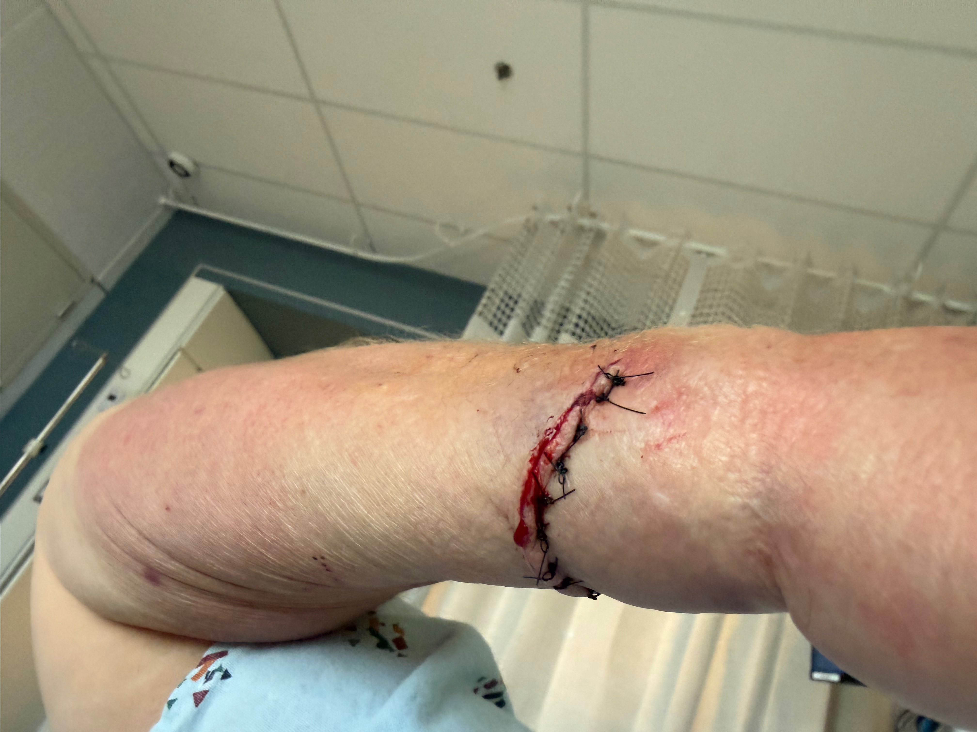 Support Mary’s Recovery After Severe Hand Injury campaign photo, 5 of 6