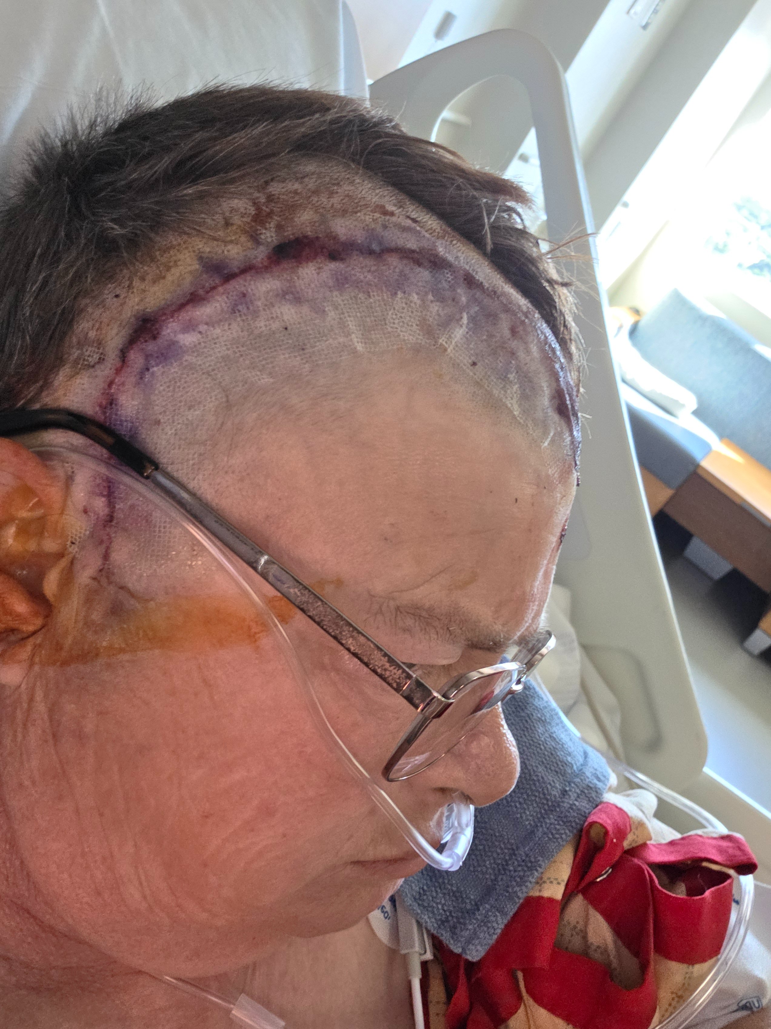 Help With Recovery After Tumor and Lung Surgery campaign photo, 2 of 5