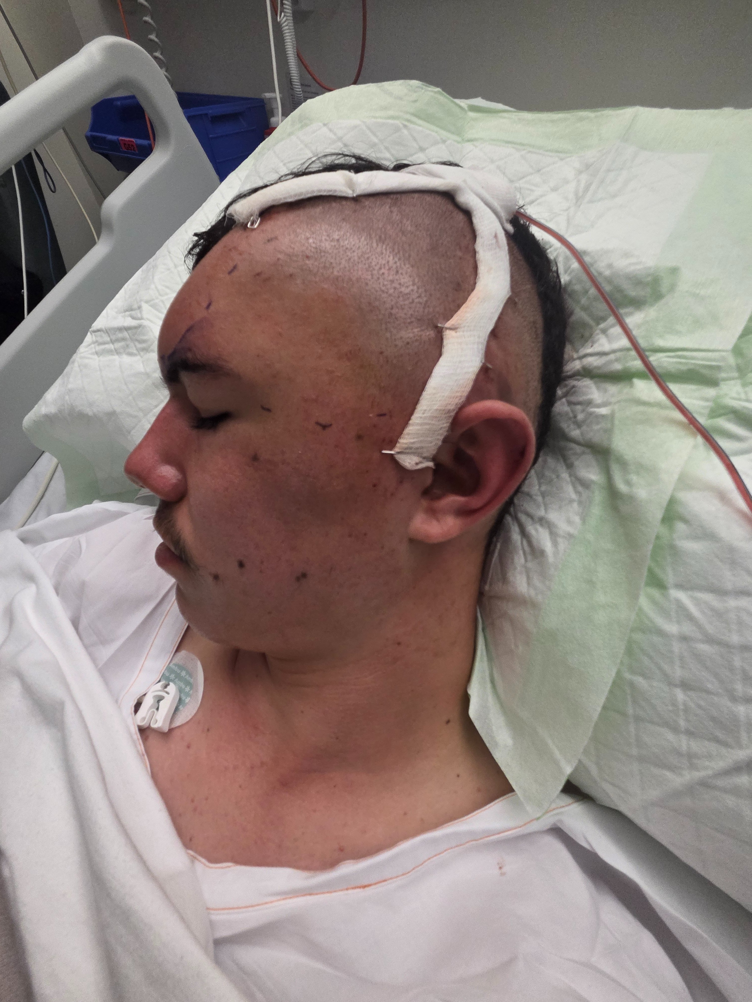 Help Alex Beat Glioblastoma - With Life Saving Treatments ! campaign photo, 2 of 4