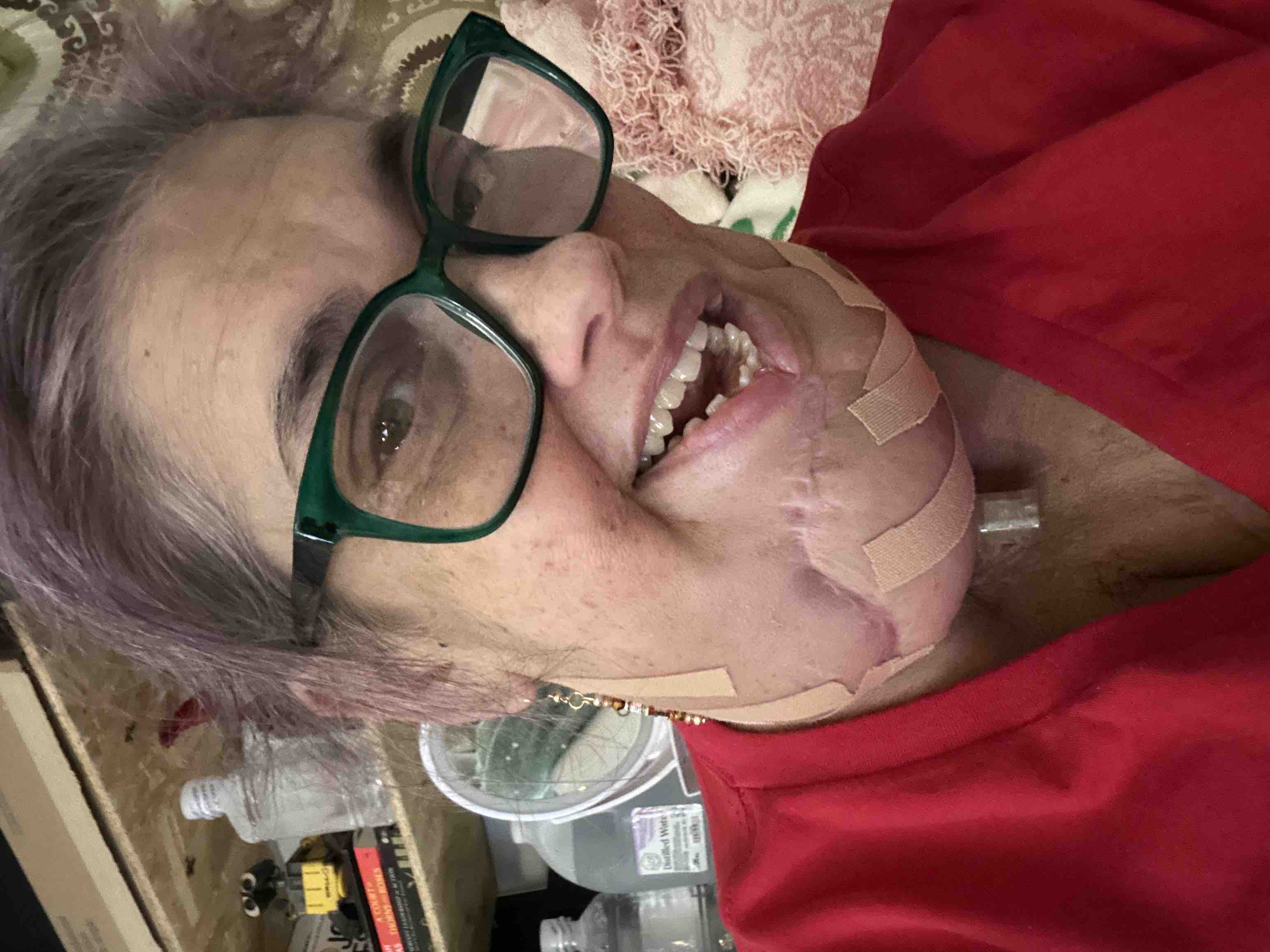 Help Aileen Recover from Oral Cancer campaign photo, 2 of 4
