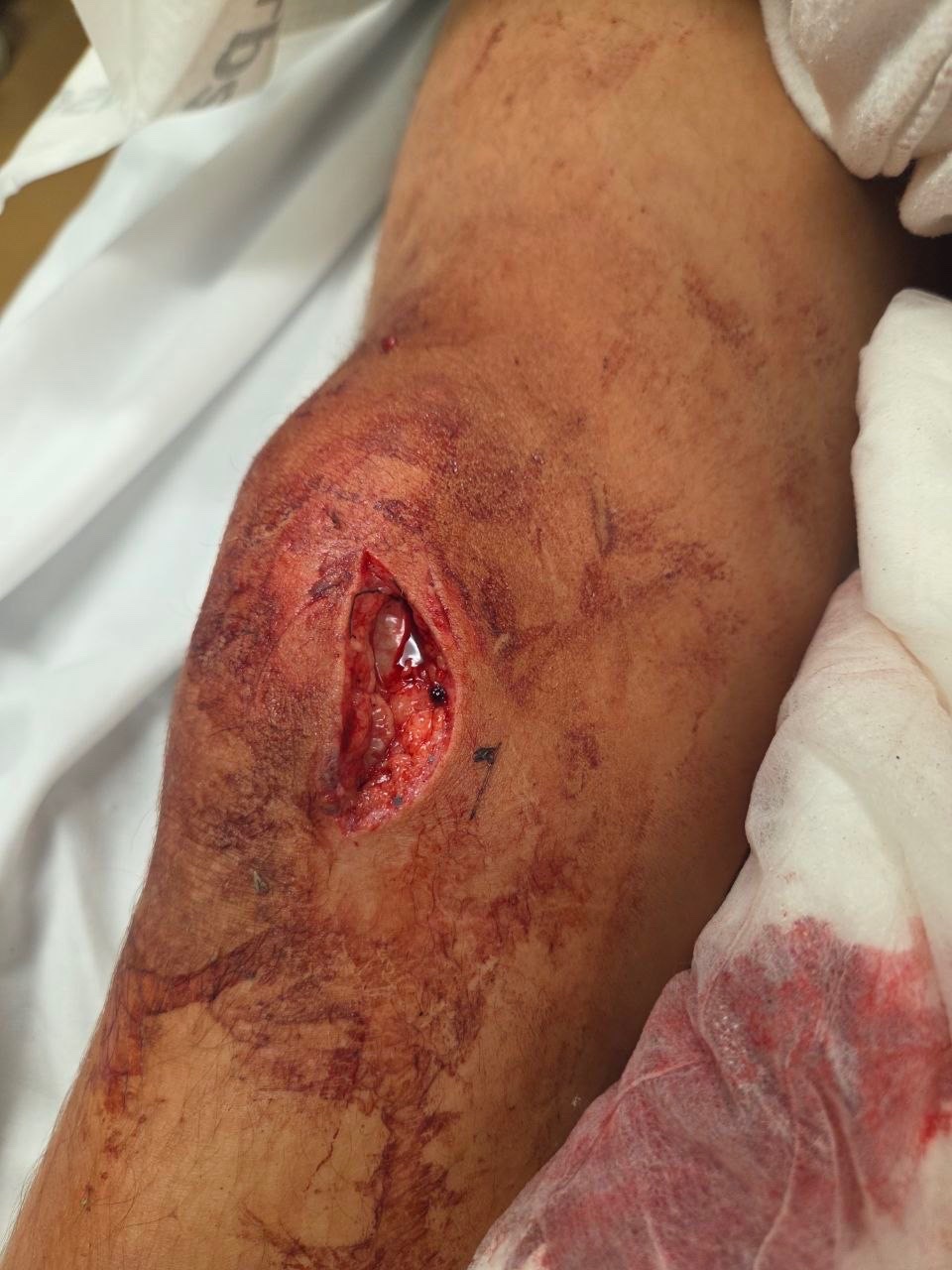 Help 16-Year-Old Mark Kurylenko Recover After a Devastating campaign photo, 7 of 8