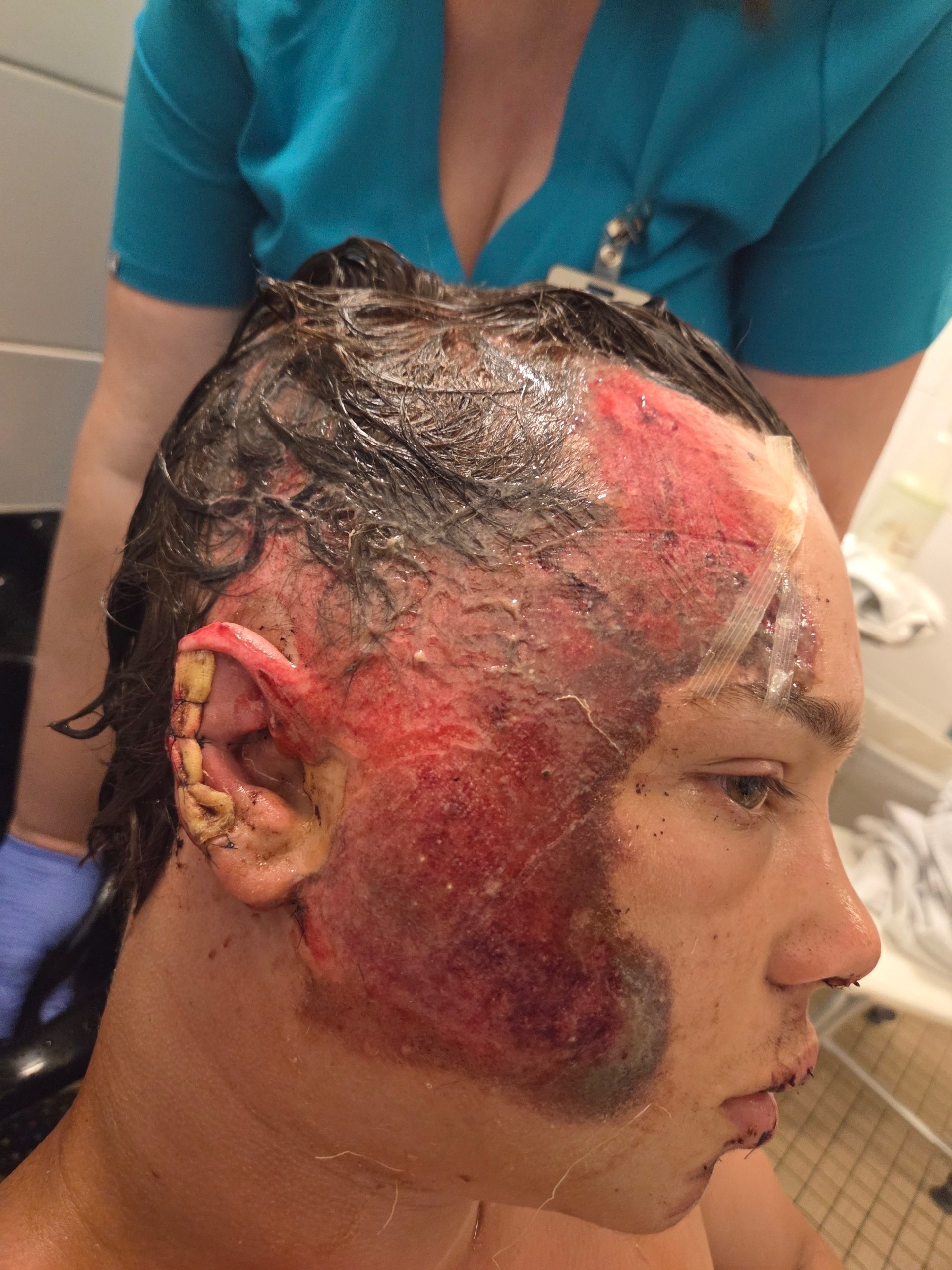 Help 16-Year-Old Mark Kurylenko Recover After a Devastating campaign photo, 4 of 8