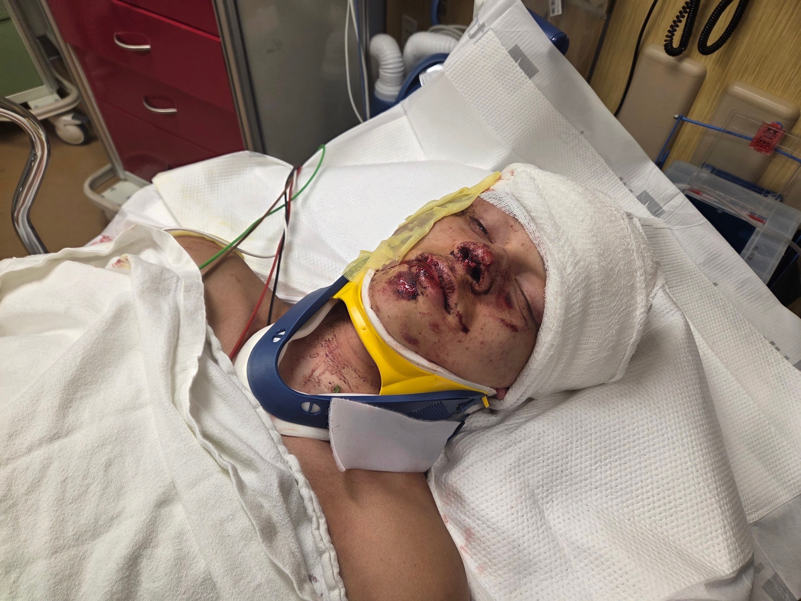 Help 16-Year-Old Mark Kurylenko Recover After a Devastating campaign photo, 5 of 8