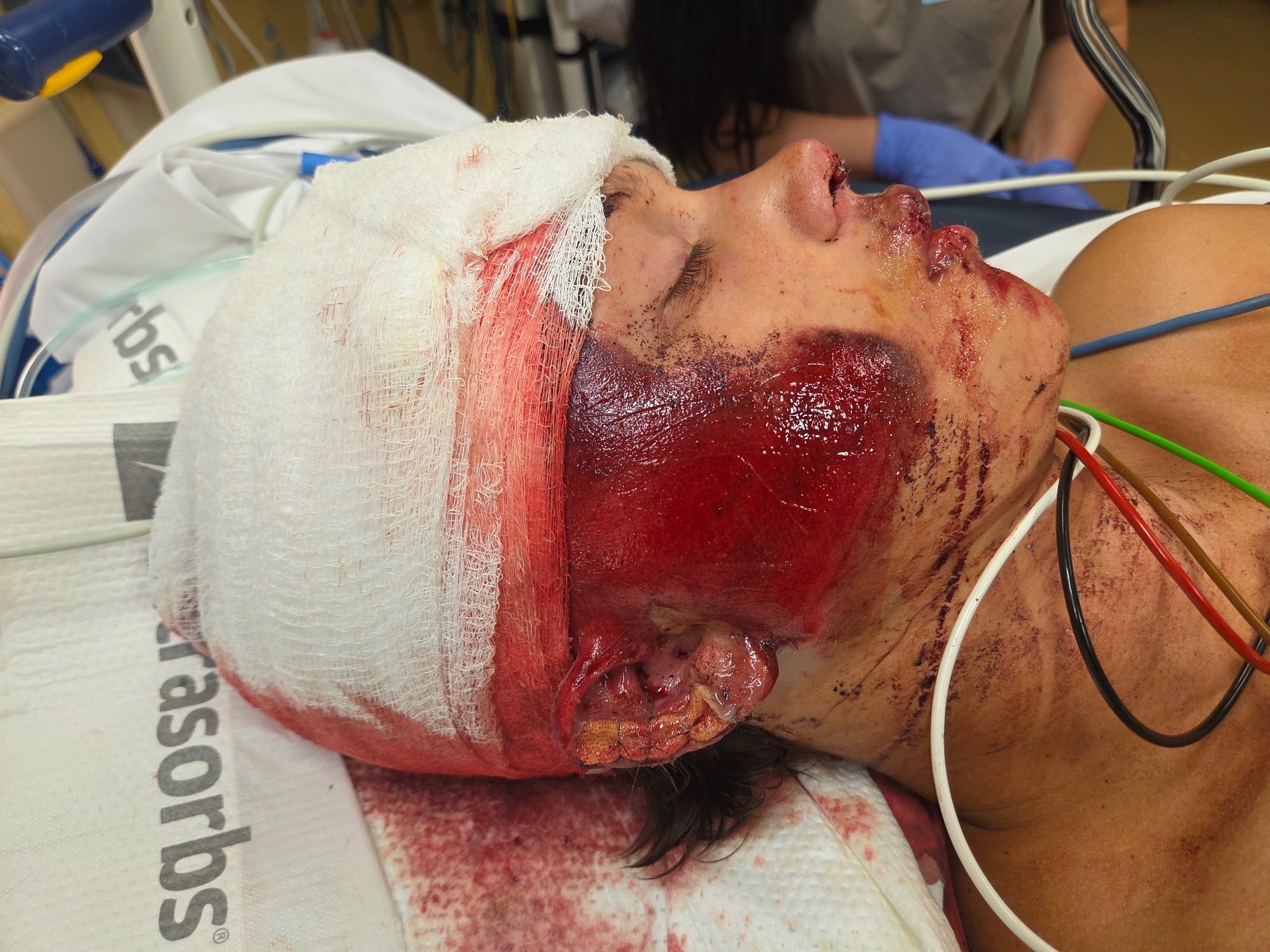 Help 16-Year-Old Mark Kurylenko Recover After a Devastating campaign photo, 6 of 8