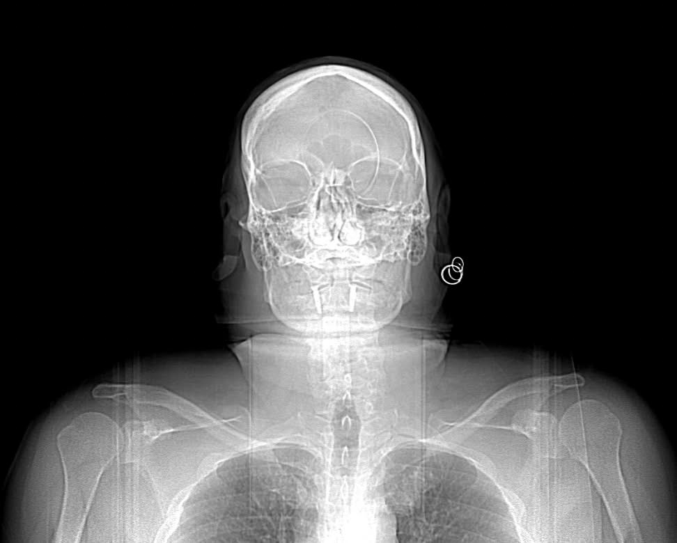 Help Roy Fight a New Cancer, Just Five Years After the Last campaign photo, 2 of 7
