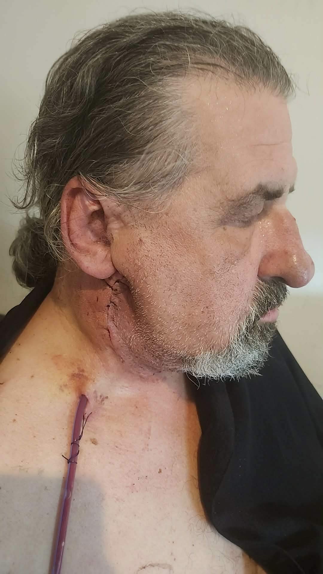 Help Roy Fight a New Cancer, Just Five Years After the Last campaign photo, 4 of 7