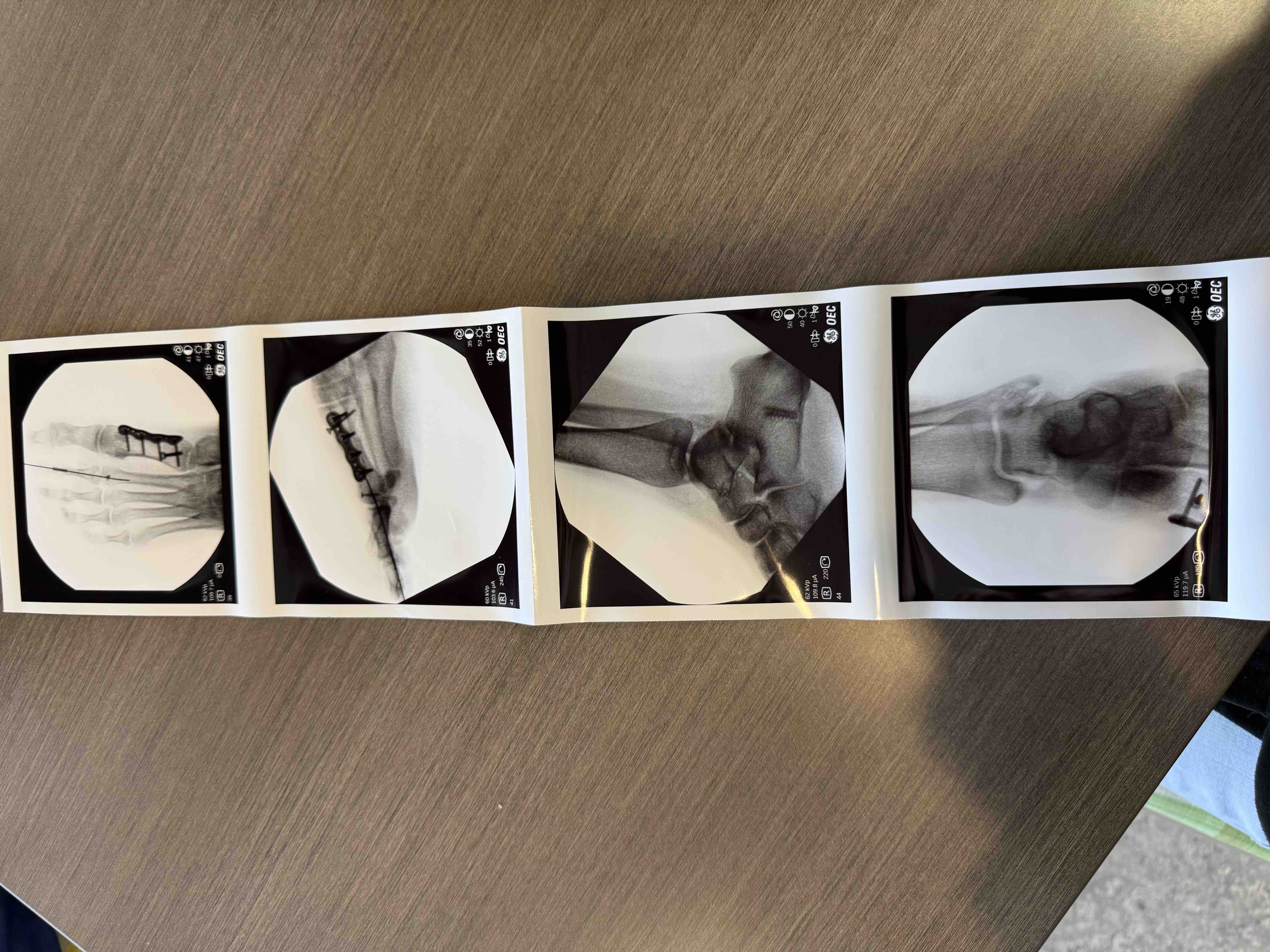 Help a Dedicated Nurse Heal and Support Her Family campaign photo, 5 of 8