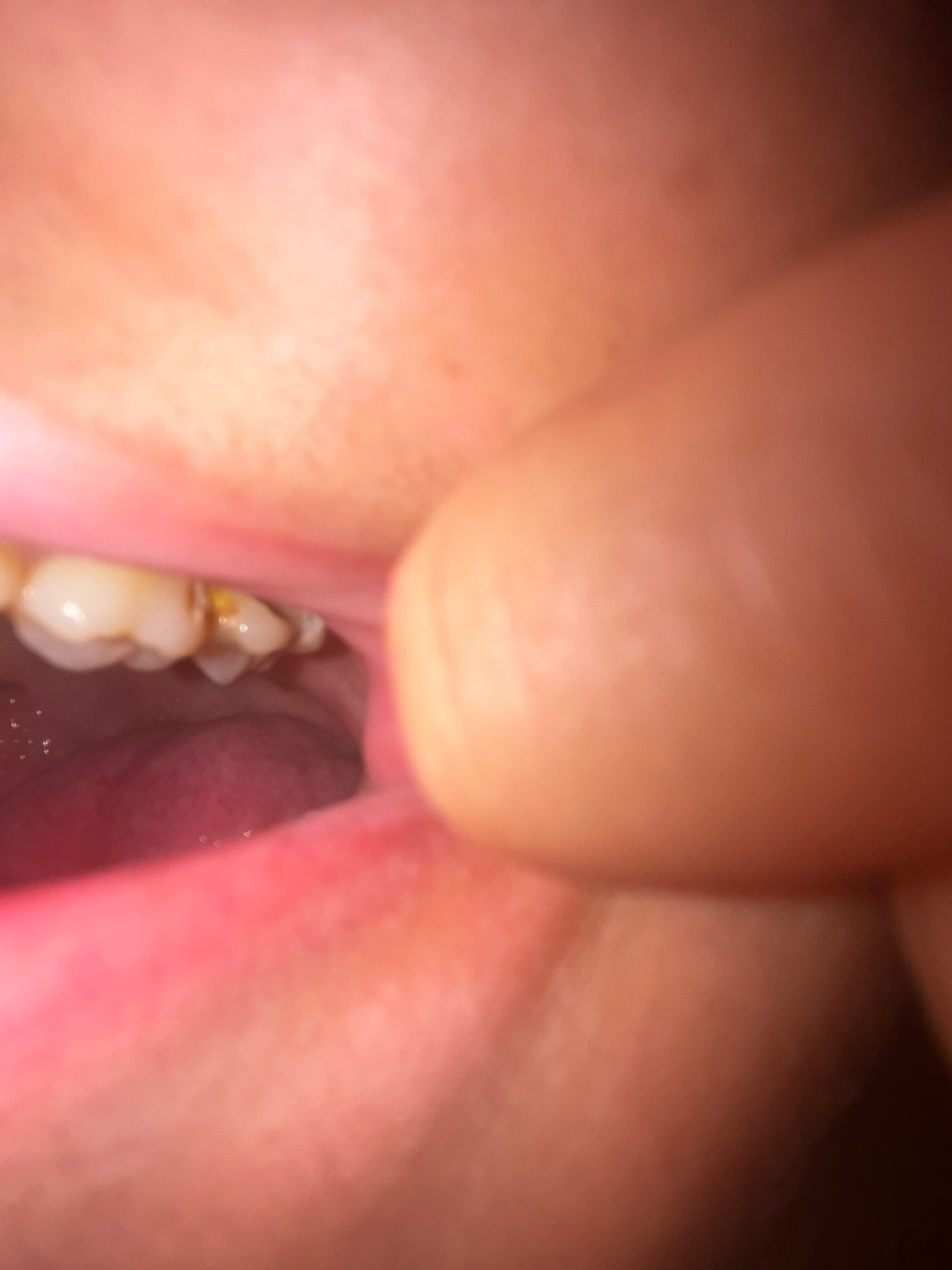 Help Me Get Emergency Dental Care campaign photo, 4 of 5