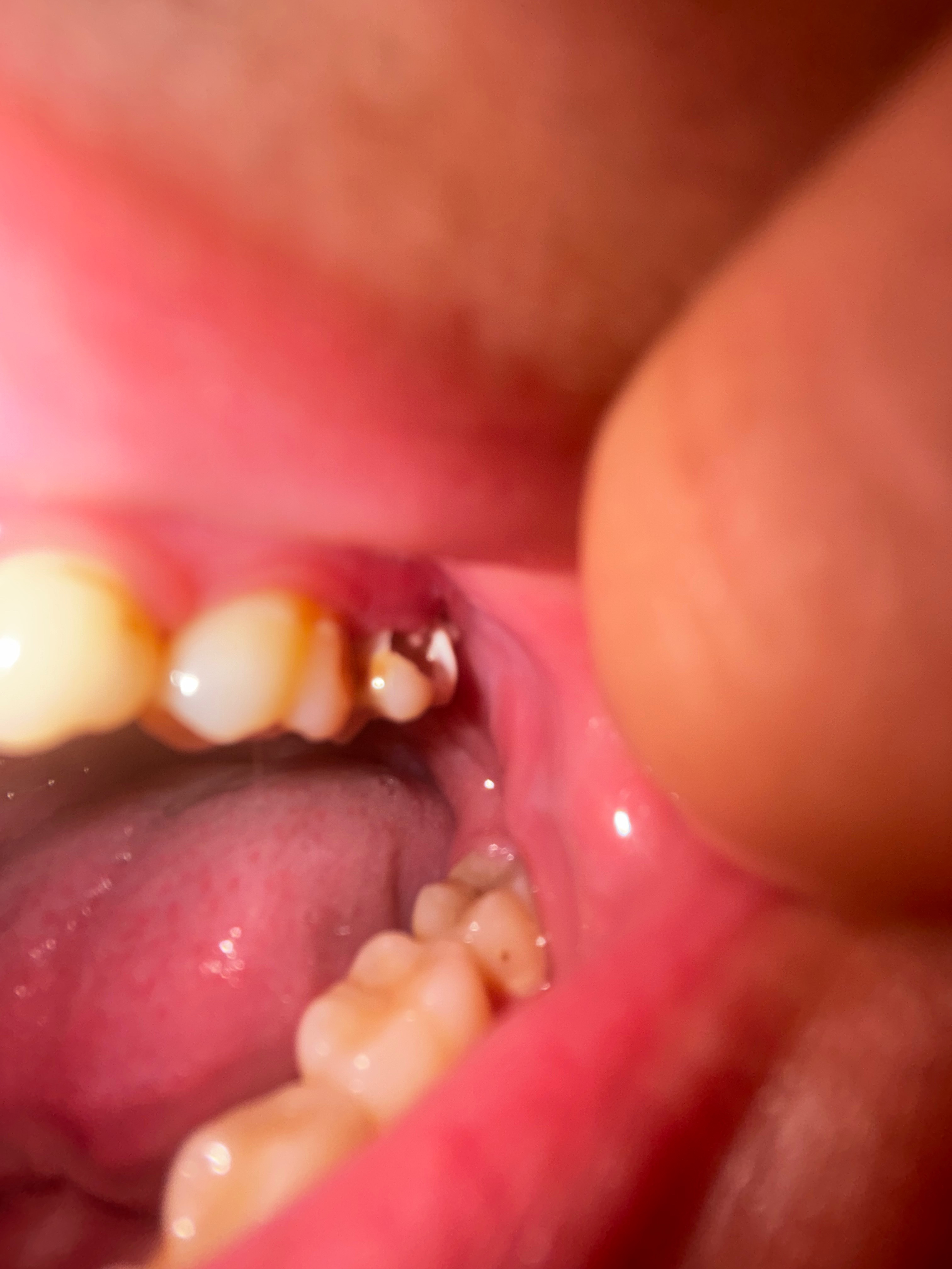 Help Me Get Emergency Dental Care campaign photo, 2 of 5