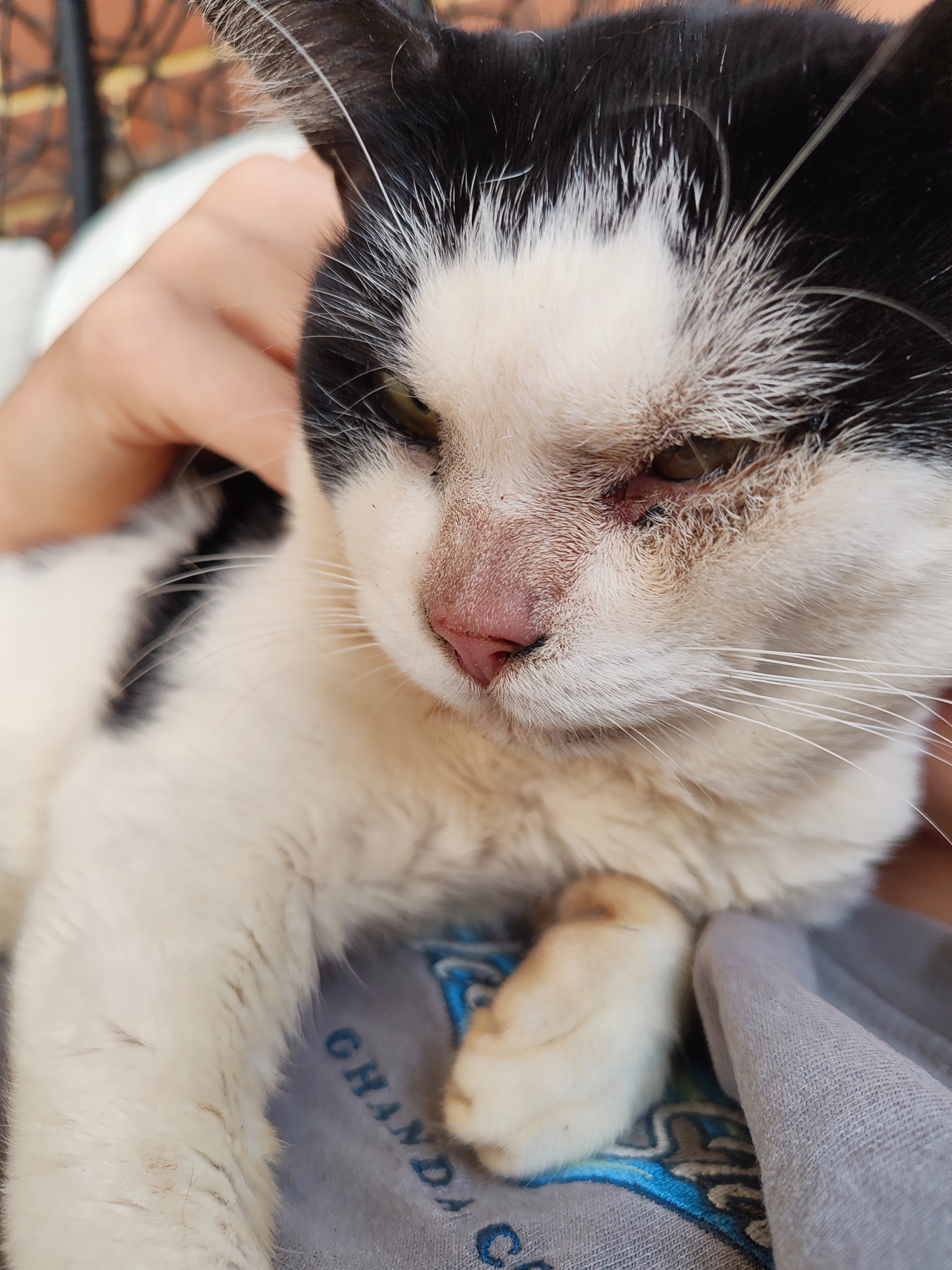 Help 2yo Martin Get Urgent Life-Saving Surgeries campaign photo, 4 of 7