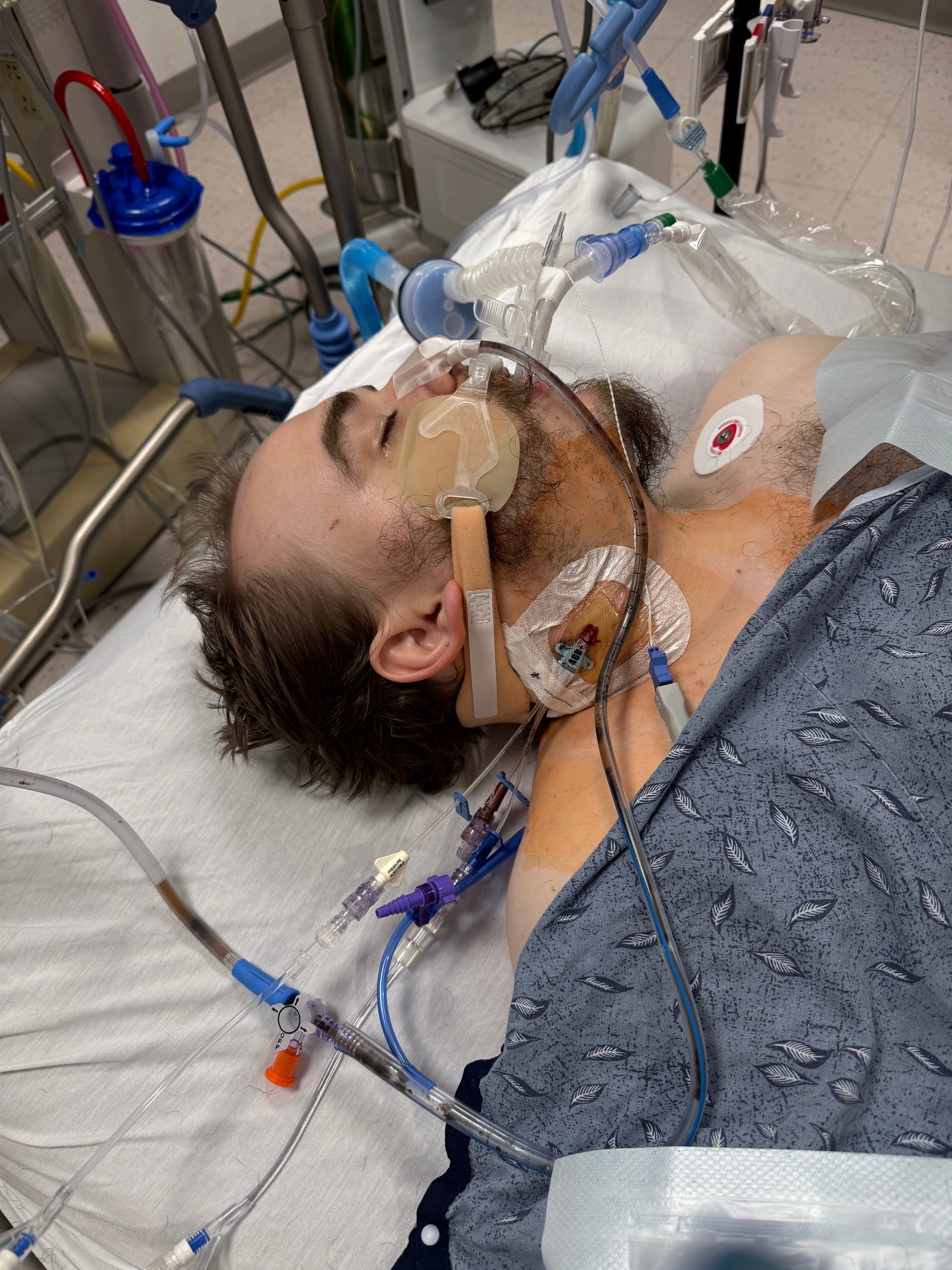 Support Justin Woodbury’s Recovery and Care campaign photo, 6 of 8