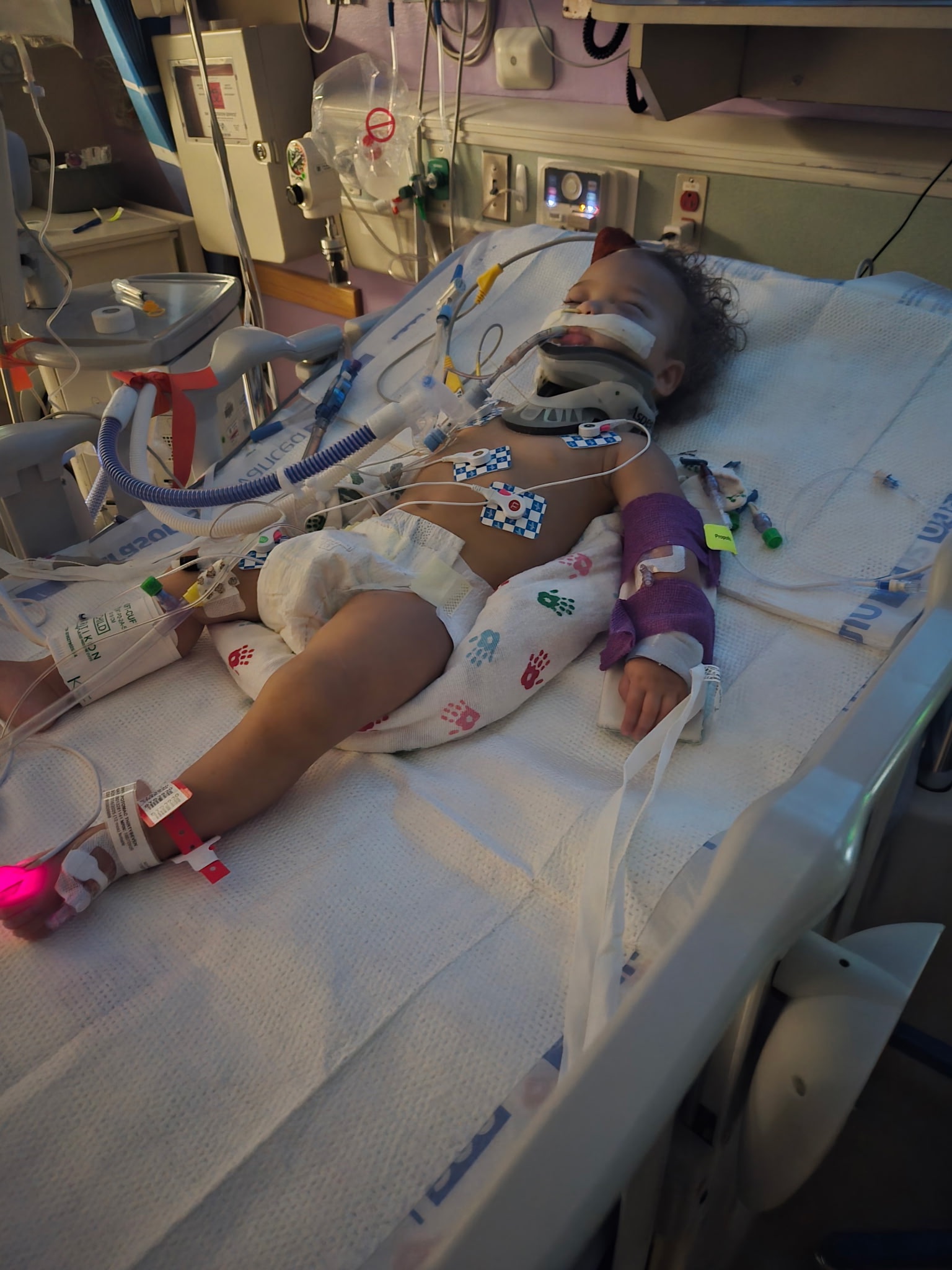Help Scarlett & Ember Recover After Accident campaign photo, 2 of 6