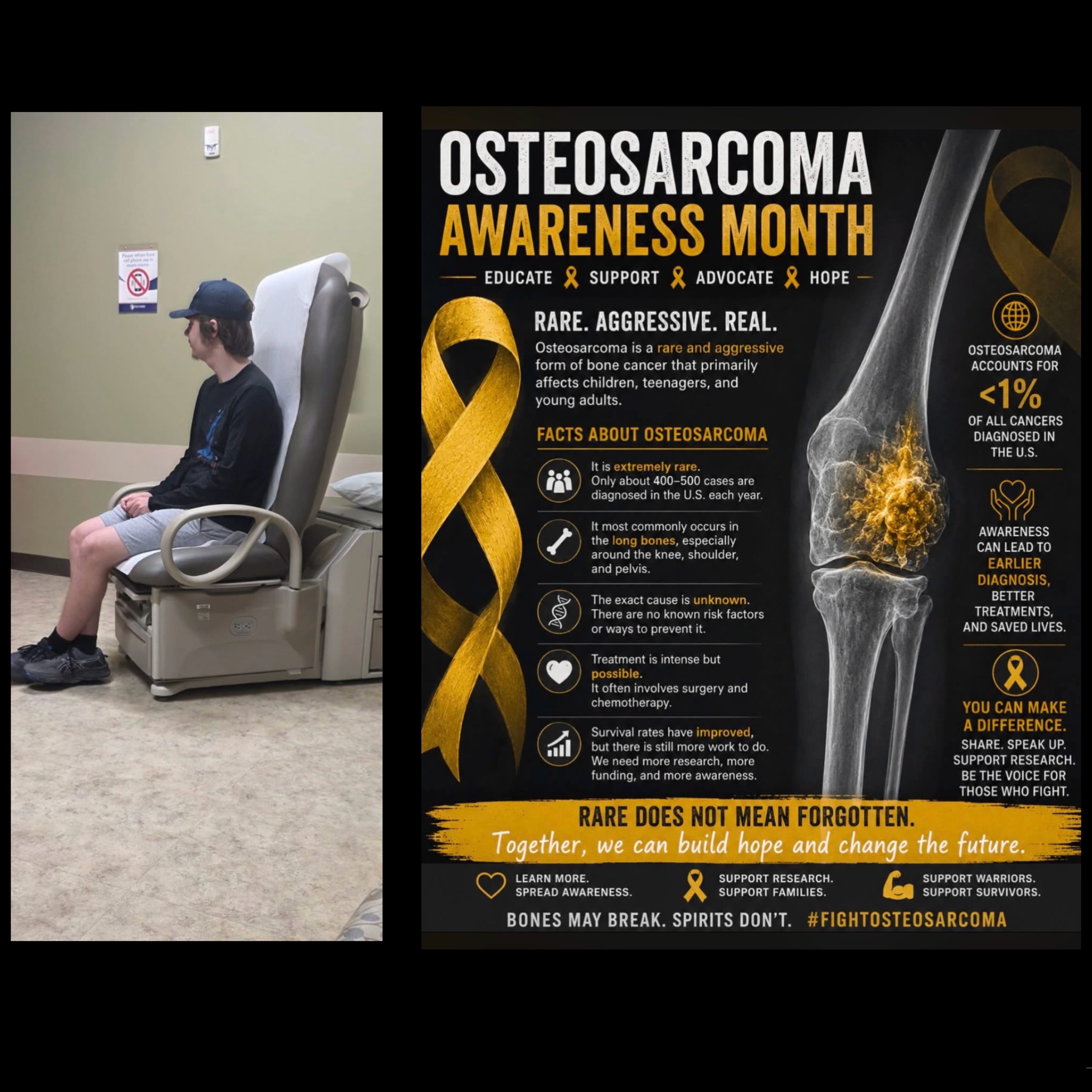 Support Damien’s Fight Against Osteosarcoma campaign photo, 2 of 6