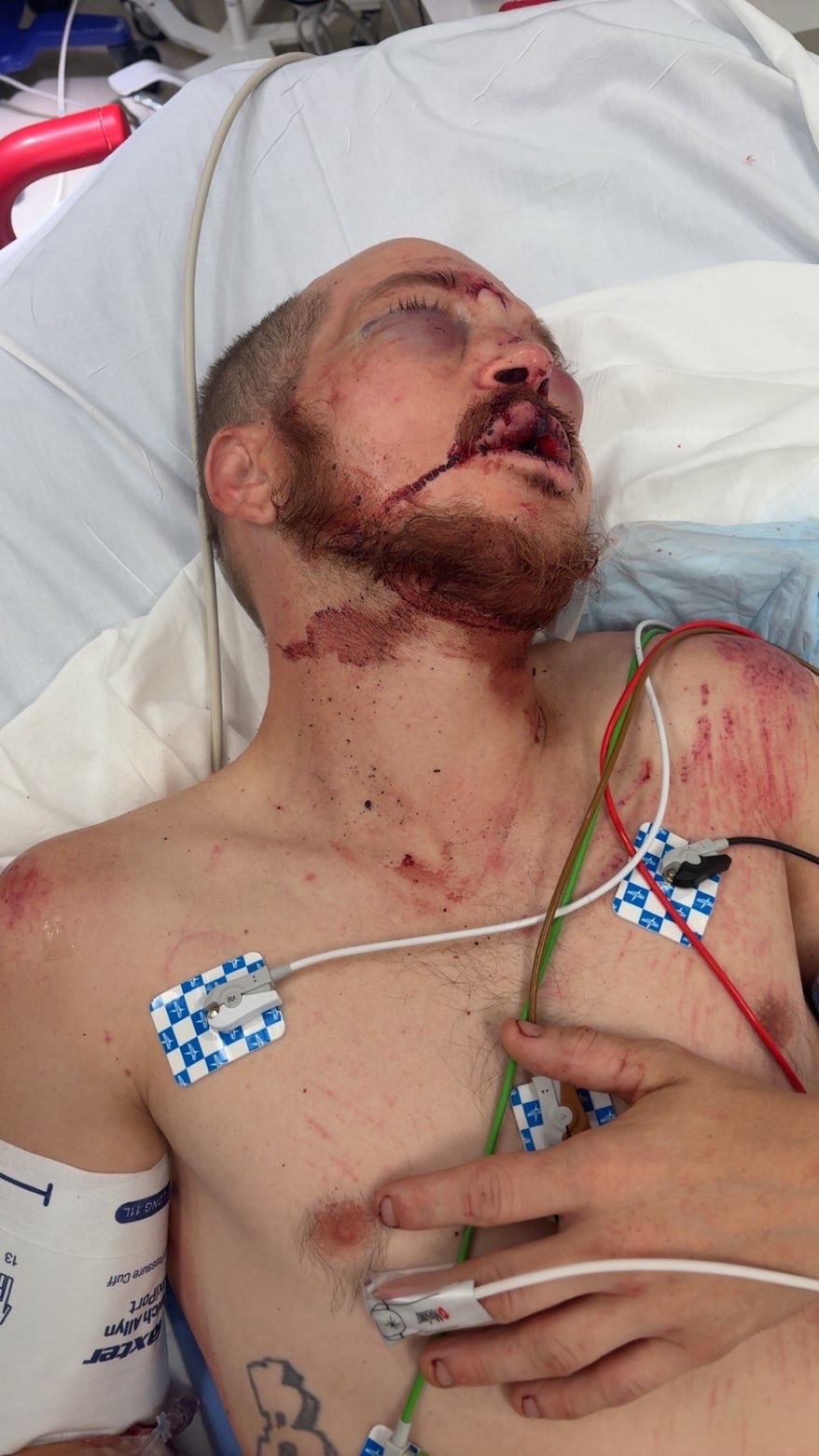 Support for Brother-in-Law’s Recovery After Attack campaign photo, 2 of 8