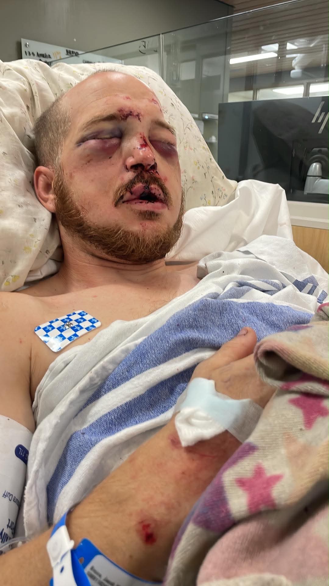 Support for Brother-in-Law’s Recovery After Attack campaign photo, 4 of 8