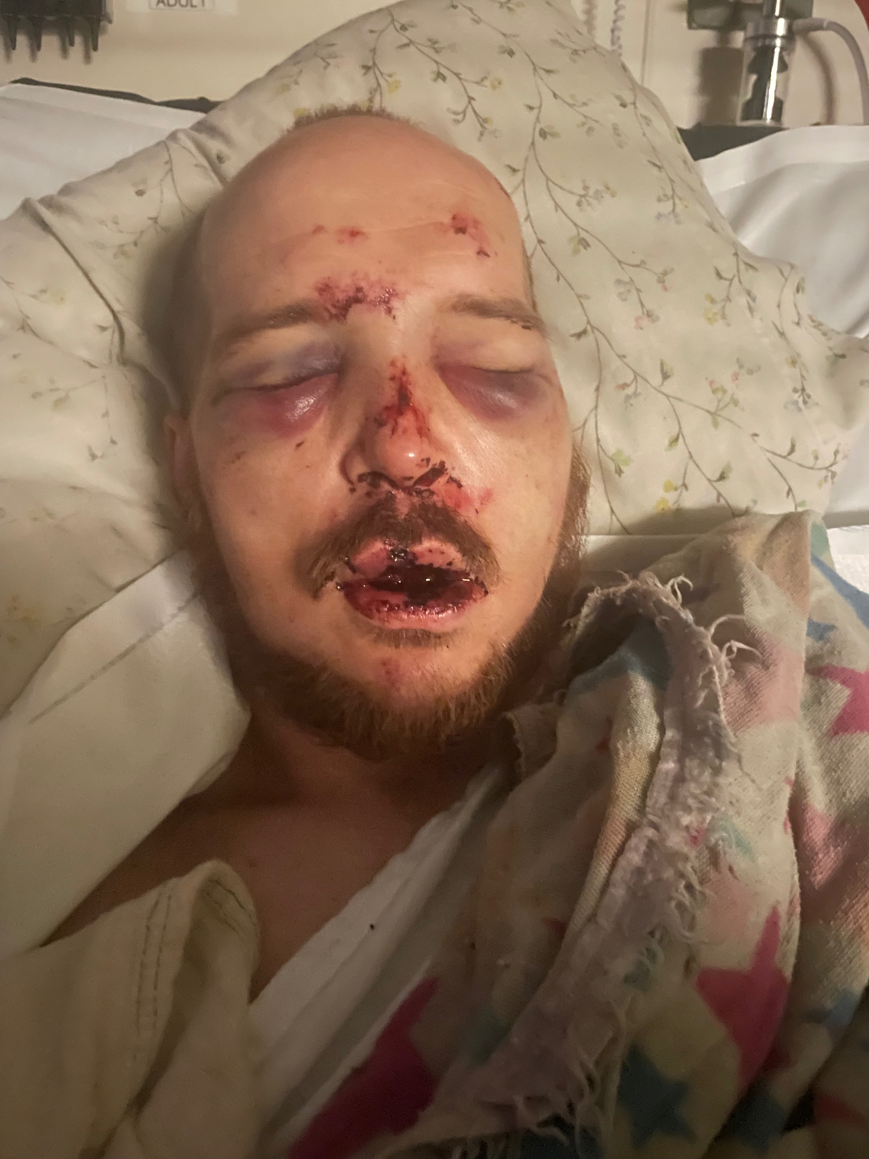 Support for Brother-in-Law’s Recovery After Attack campaign photo, 5 of 8