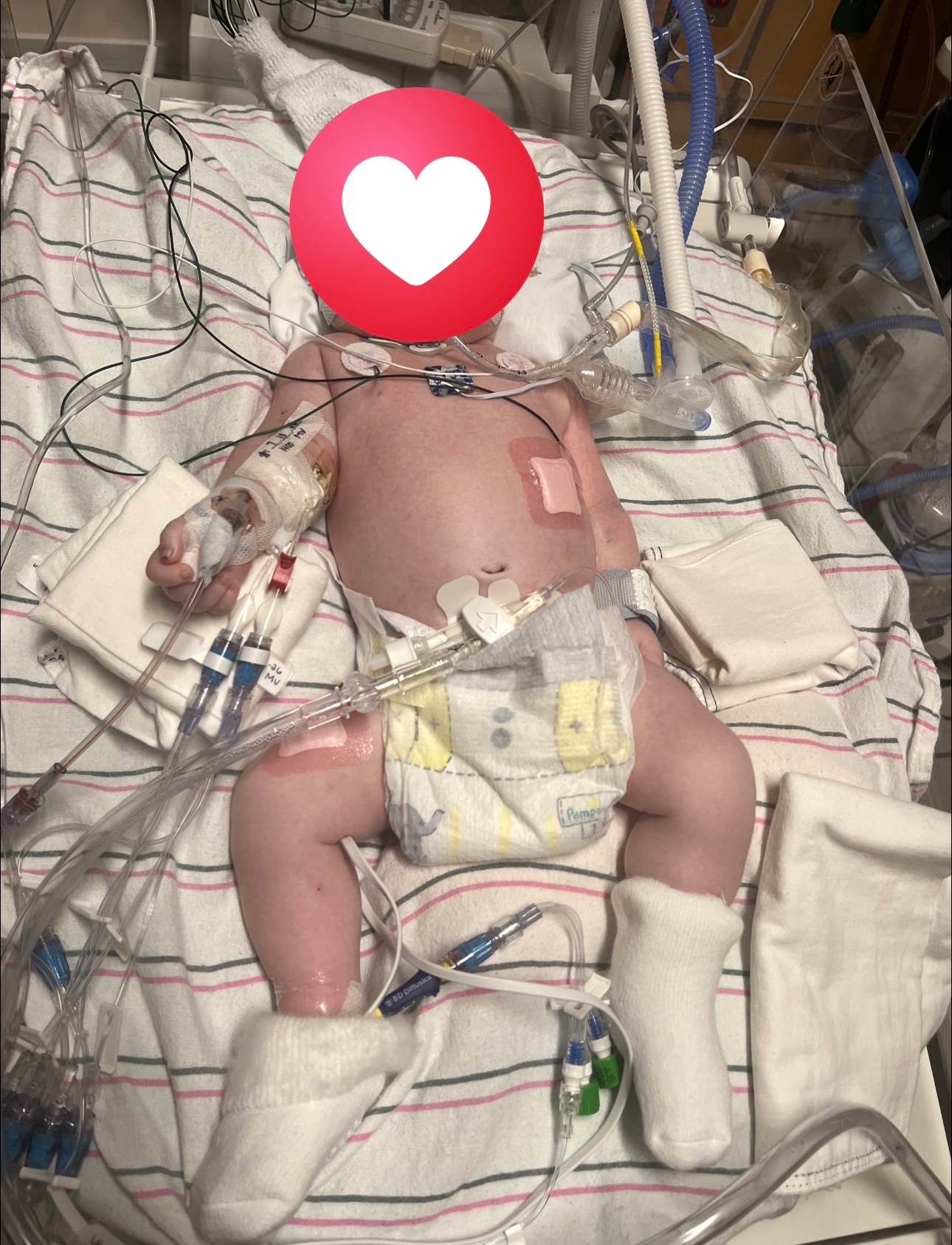 Help the parents Stay Close to Baby Slentz in the PICU campaign photo, 2 of 4