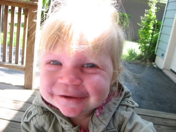 Help Ava Get Life-Changing Treatment campaign photo, 9 of 10