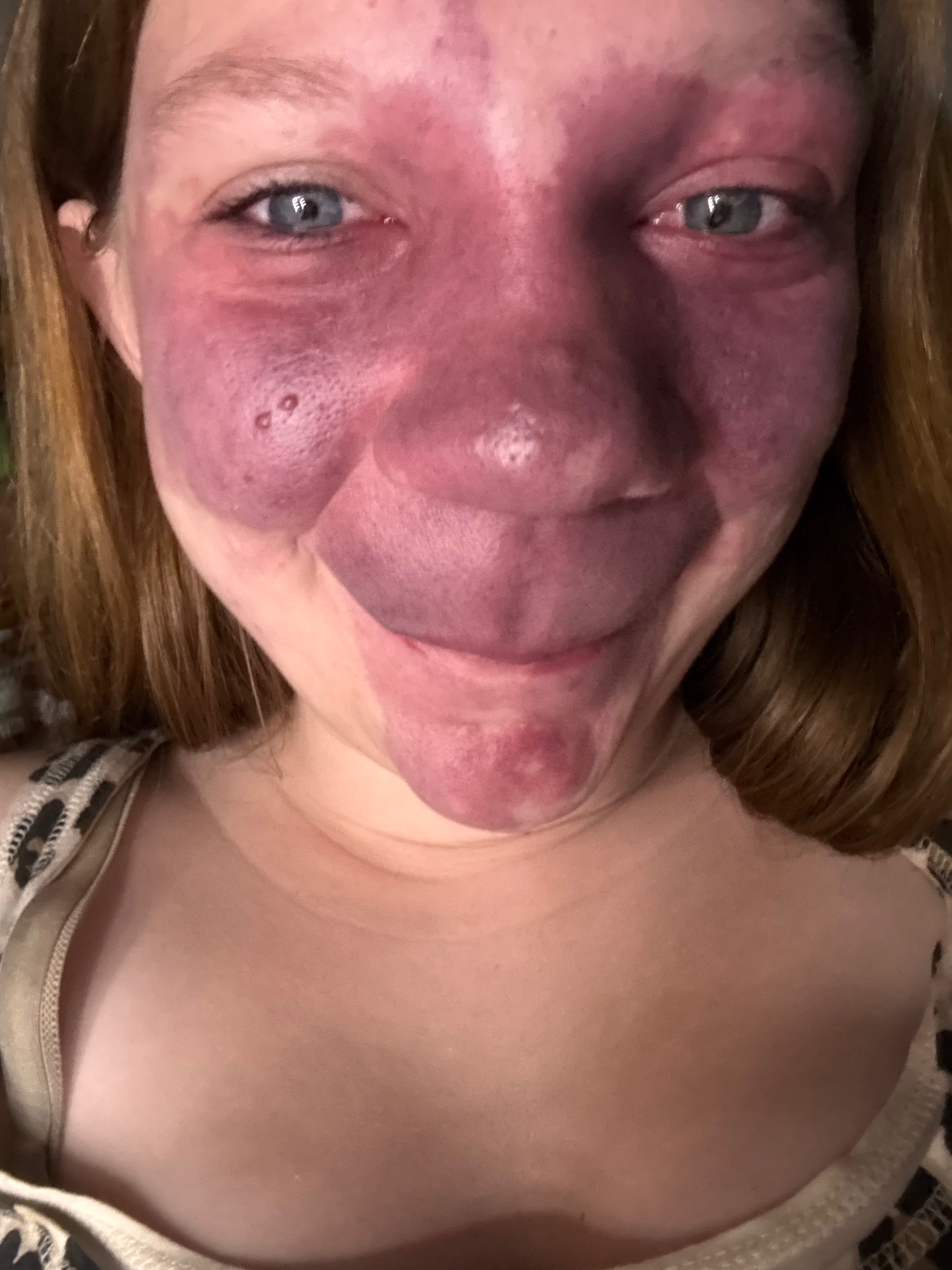 Help Ava Get Life-Changing Treatment campaign photo, 4 of 10