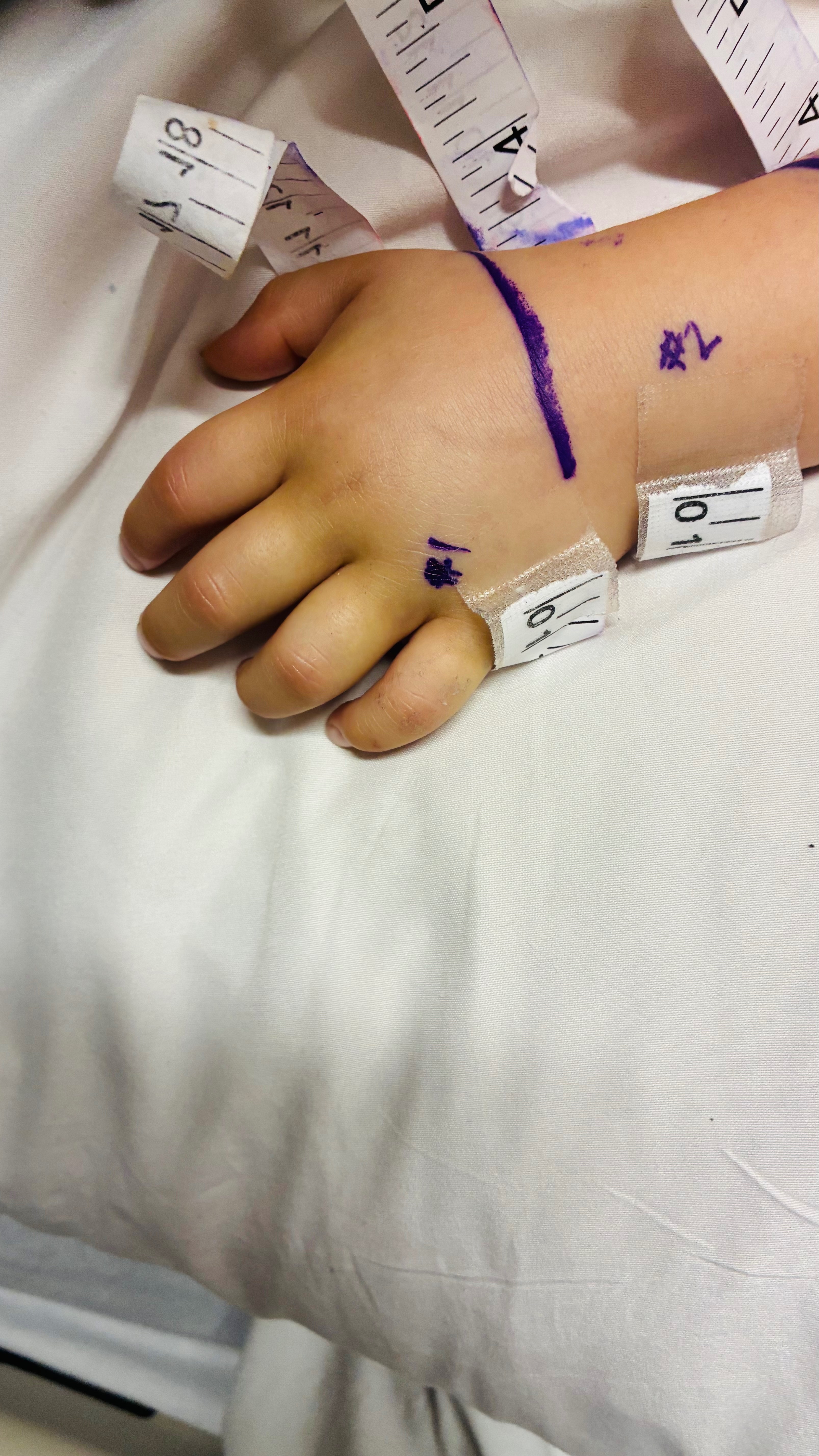 Help Addy Recover After Rattlesnake Bite campaign photo, 4 of 8