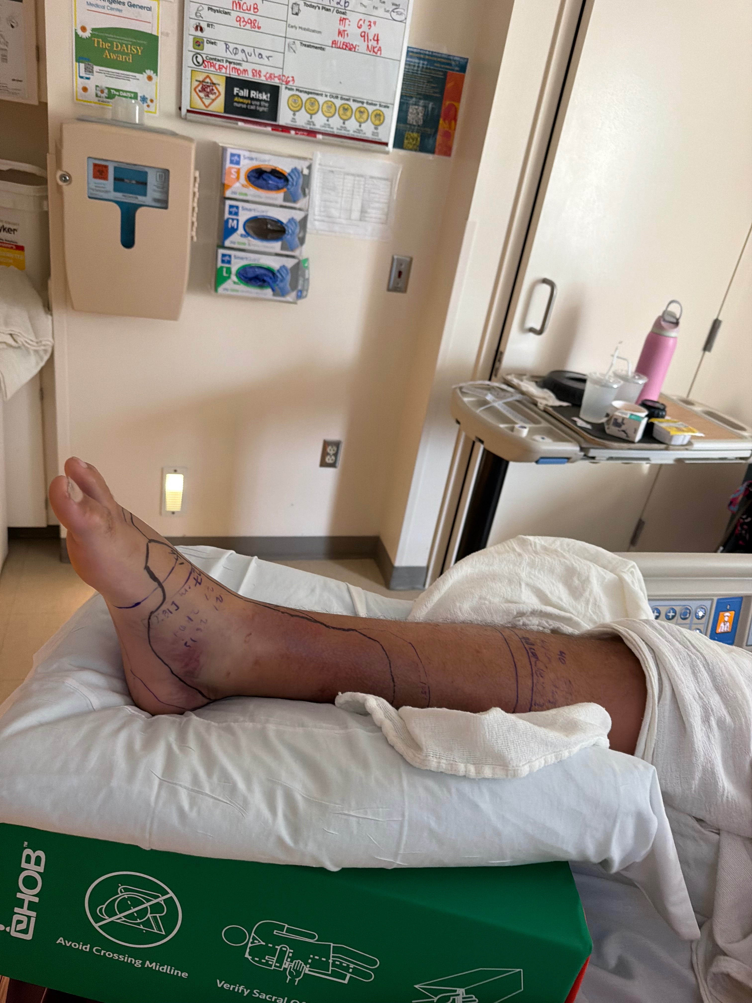 Help Jake Recover After Rattlesnake Bite campaign photo, 2 of 8