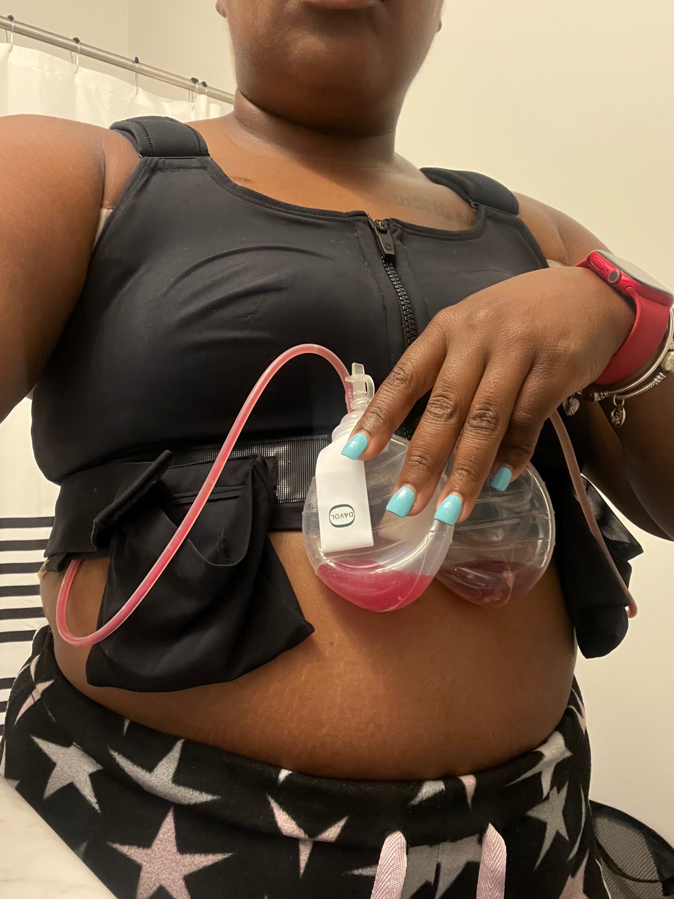 Support Imani’s 12week healing after breast reconstruction campaign photo, 4 of 8