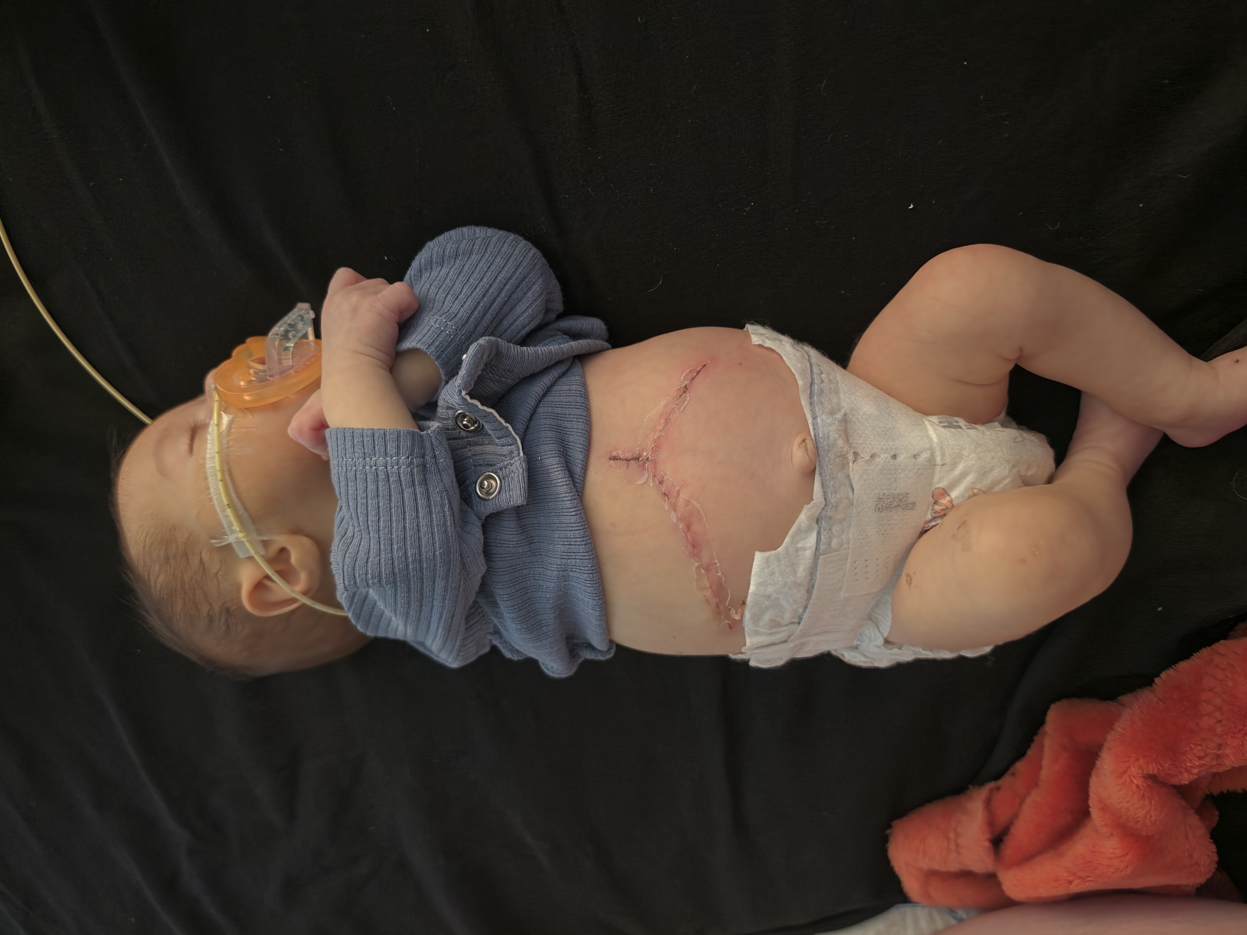 Help Xalia Get A Lifesaving Liver Transplant campaign photo, 6 of 13