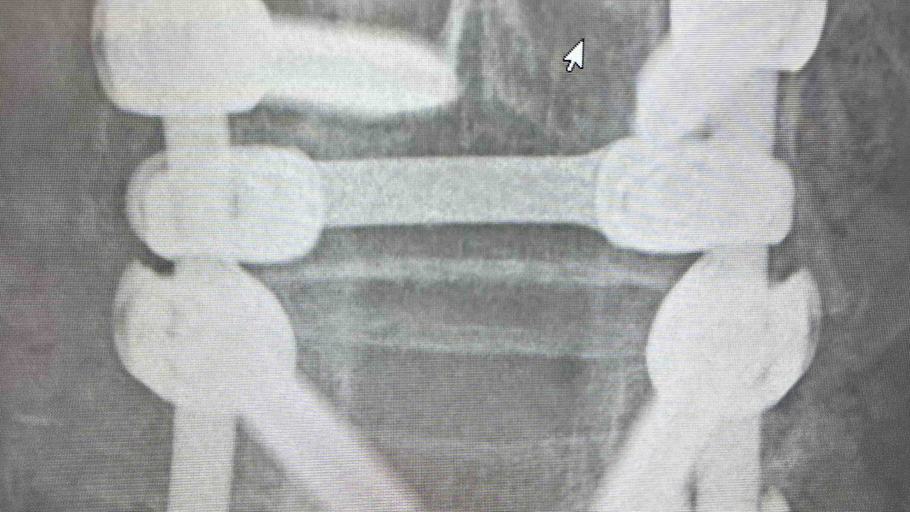 Fundraiser by Joseph Kenyon : Help Joe Recover from Spinal Cord