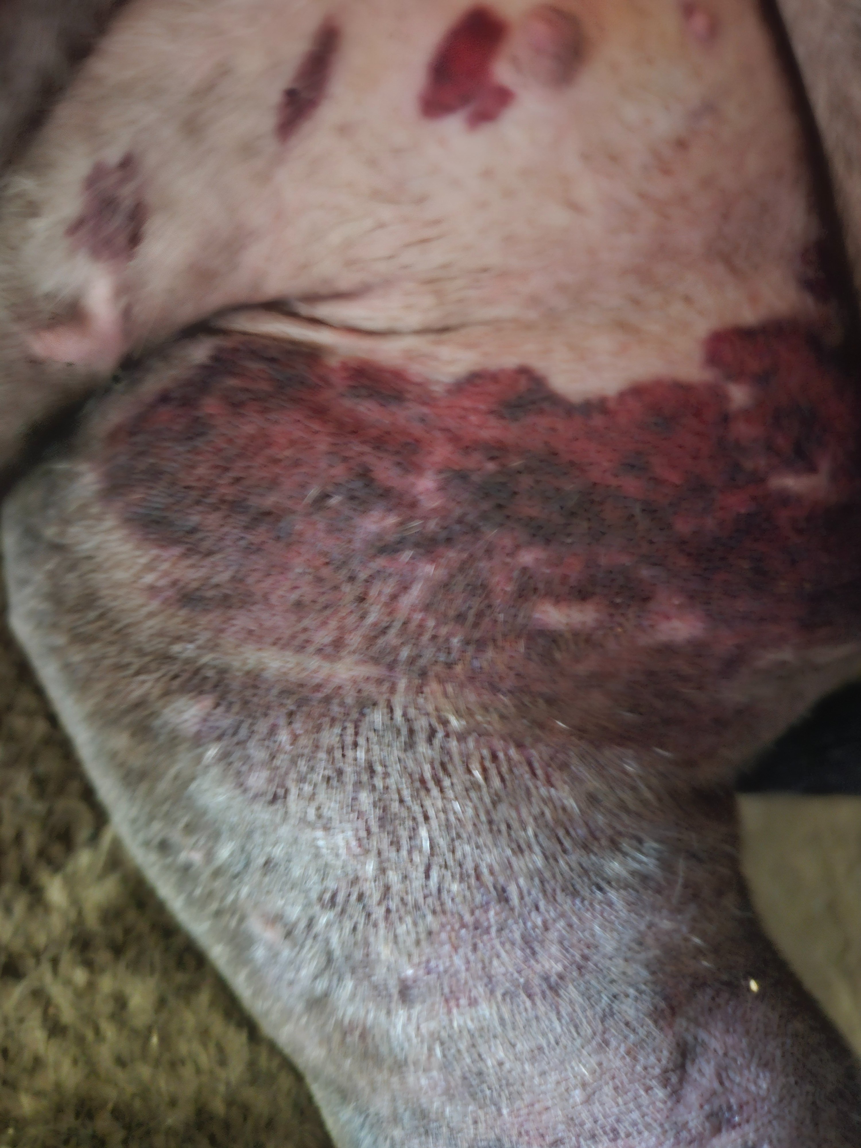 Help Baby Recover from Rattlesnake Bite campaign photo, 5 of 6