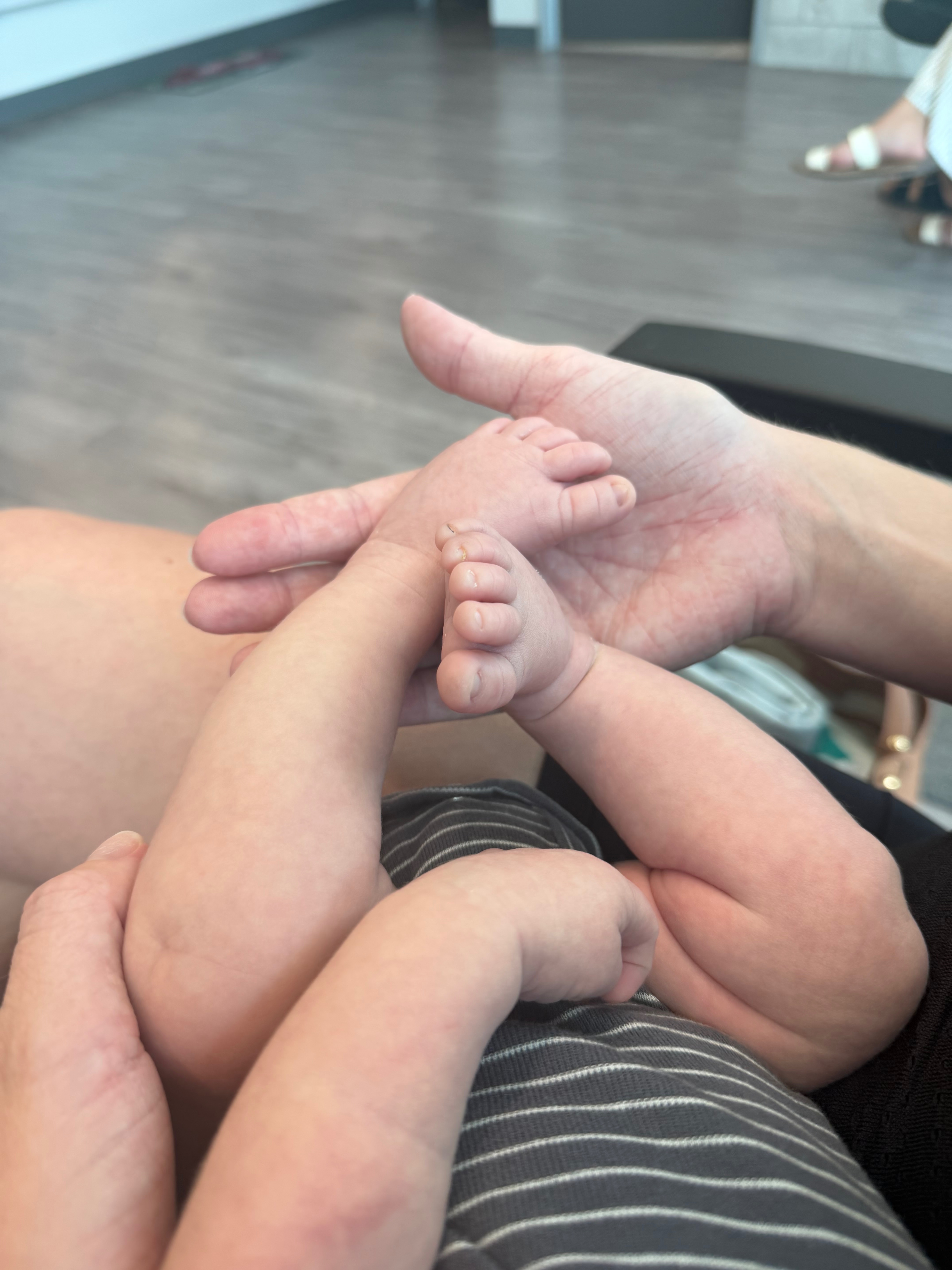 Helping Families with Clubfoot Treatment Costs campaign photo, 2 of 4