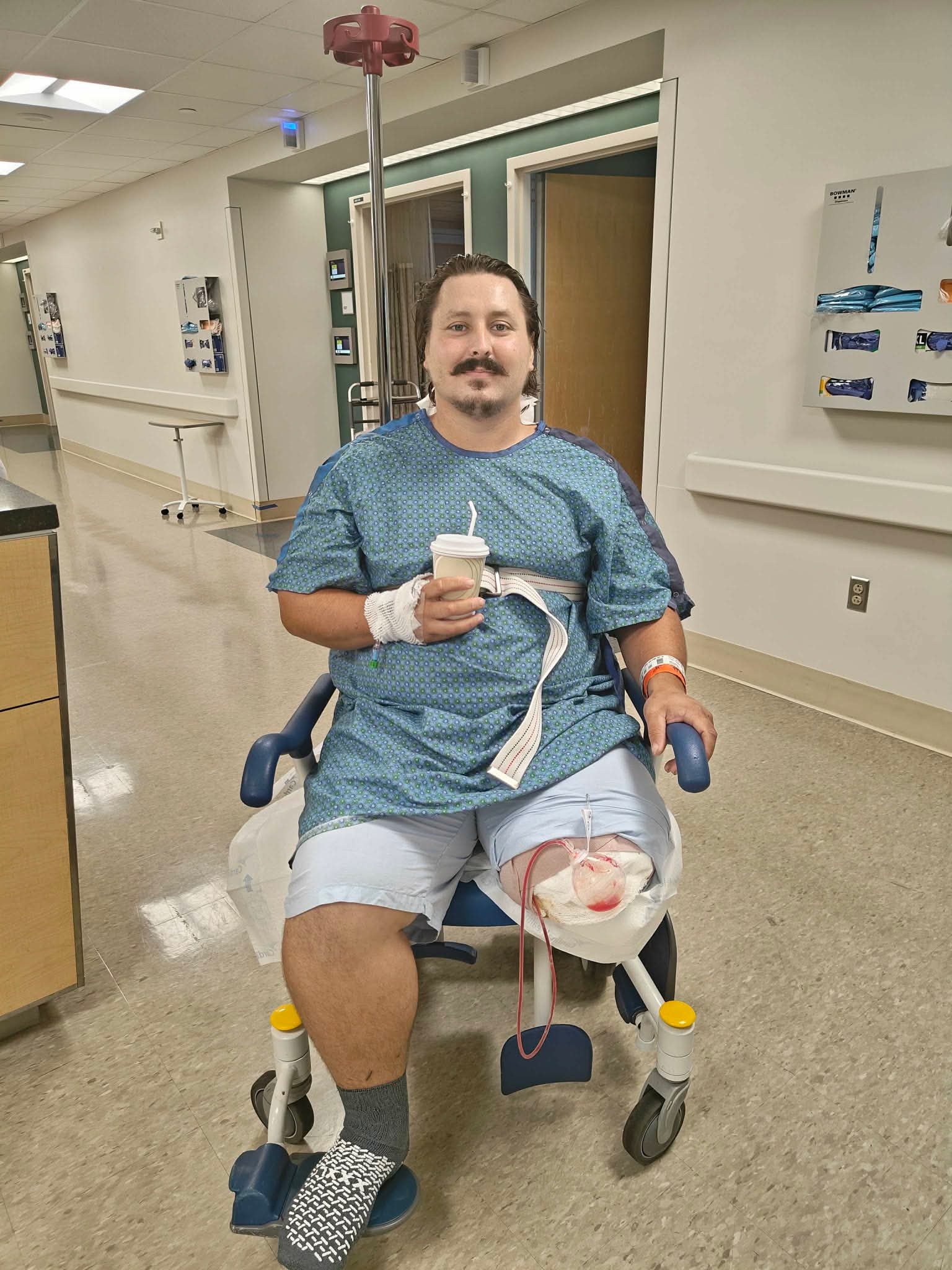 Please help Steven Polson after losing his leg campaign photo, 4 of 5