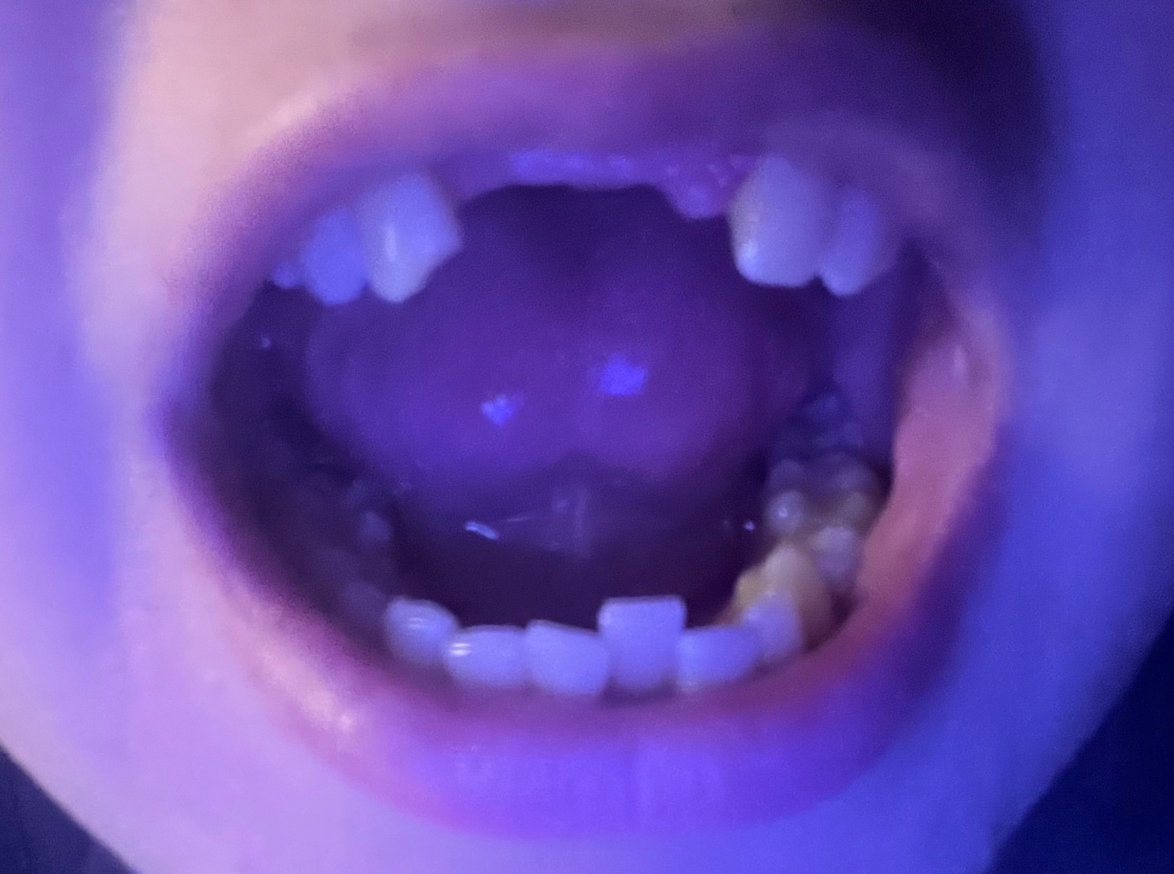 Help Restore My Smile After Accident campaign photo, 4 of 6