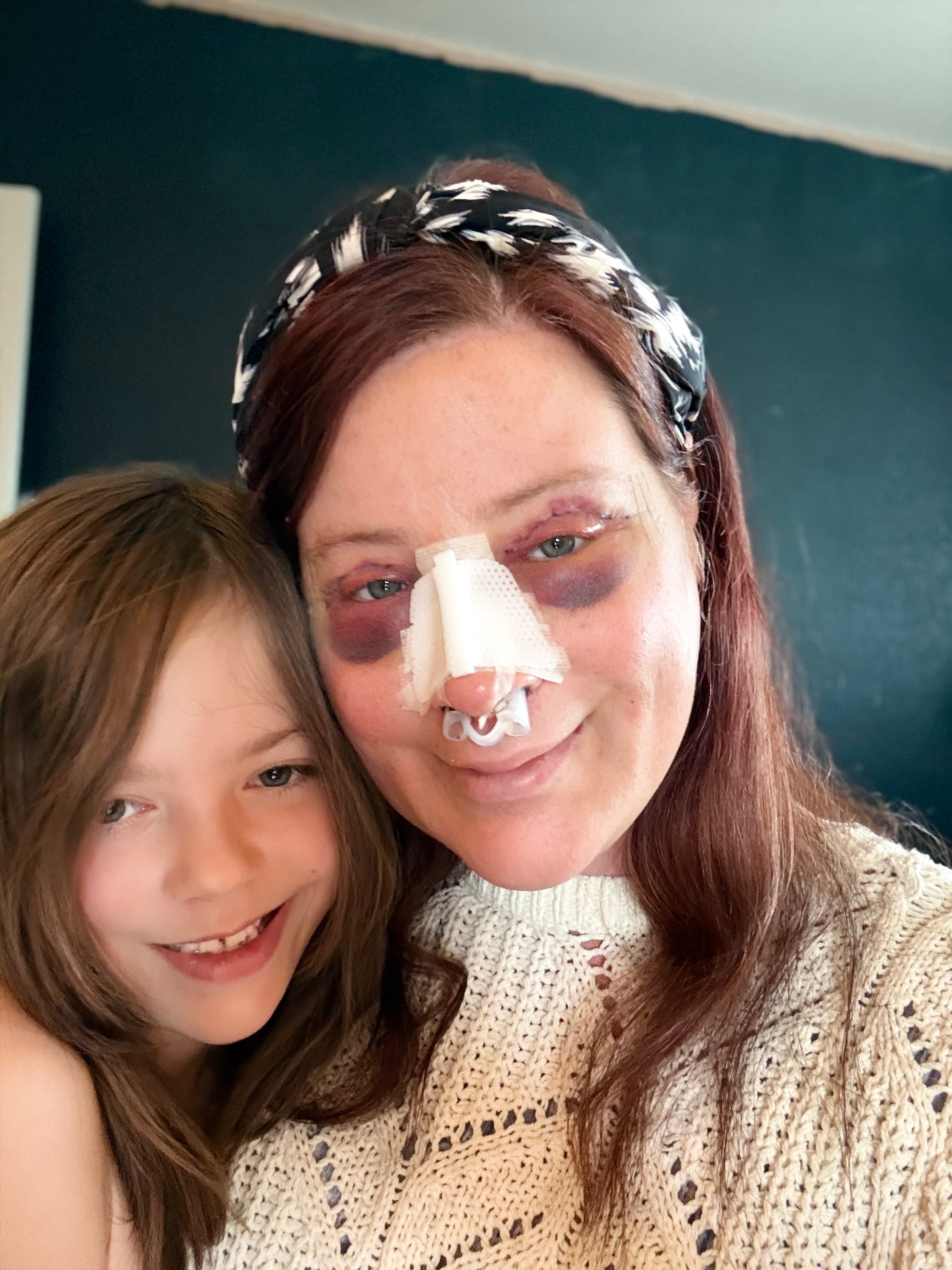 Support Josie: Gender-Affirming Surgery & Recovery campaign photo, 2 of 13