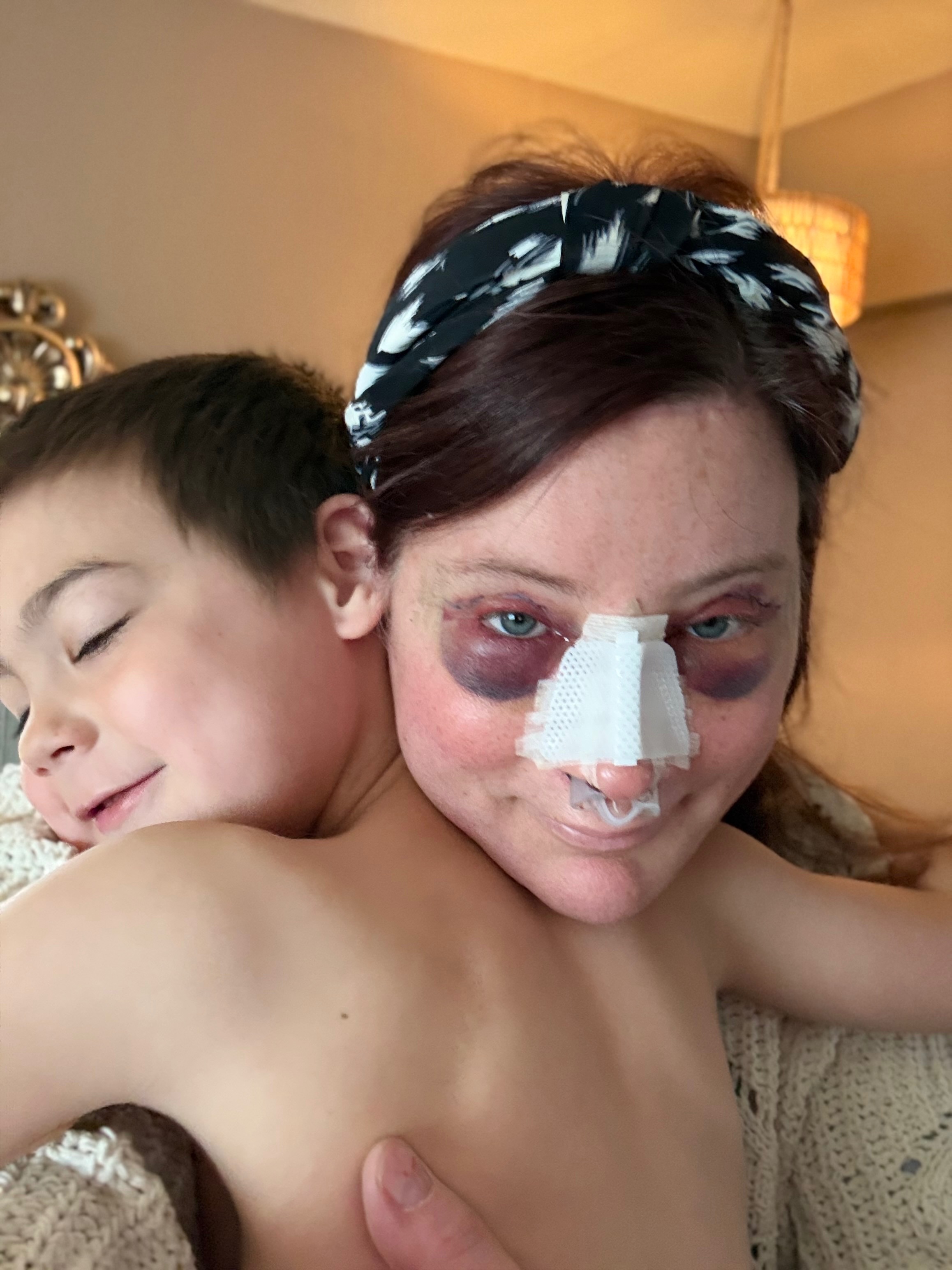 Support Josie: Gender-Affirming Surgery & Recovery campaign photo, 4 of 13