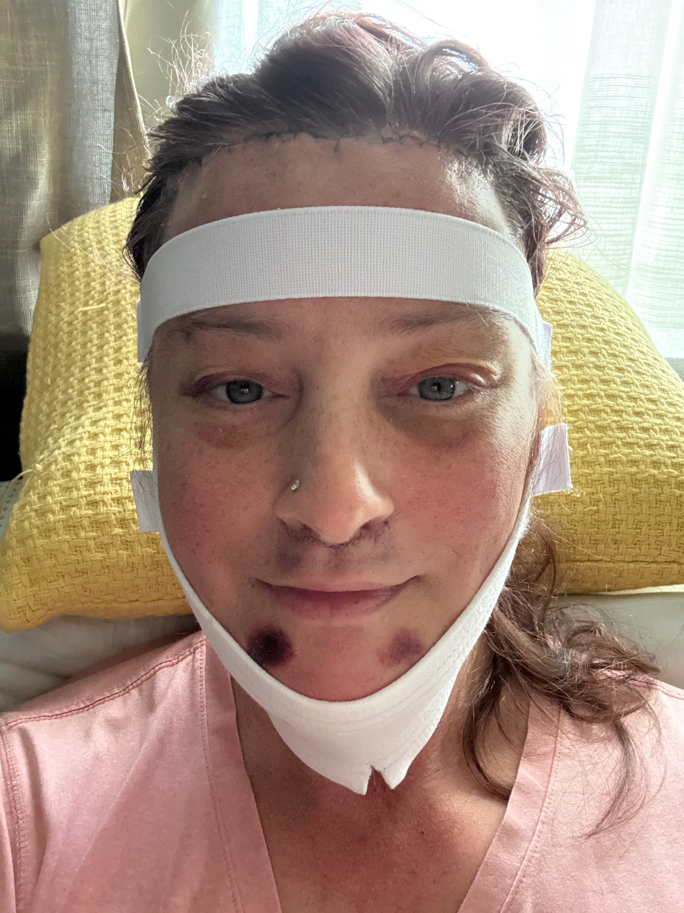 Support Josie: Gender-Affirming Surgery & Recovery campaign photo, 5 of 13
