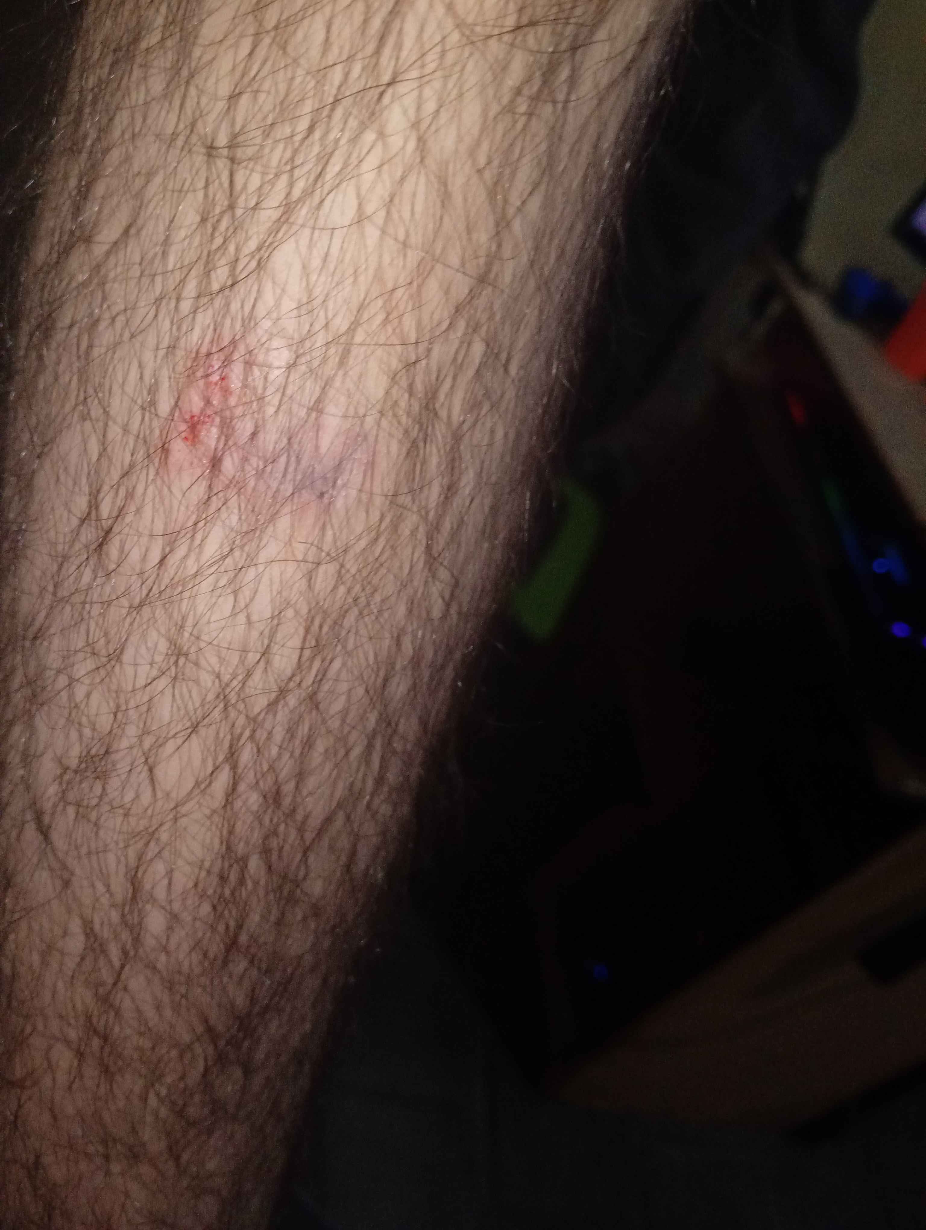 Help my girlfriend escape her abusive household campaign photo, 6 of 7