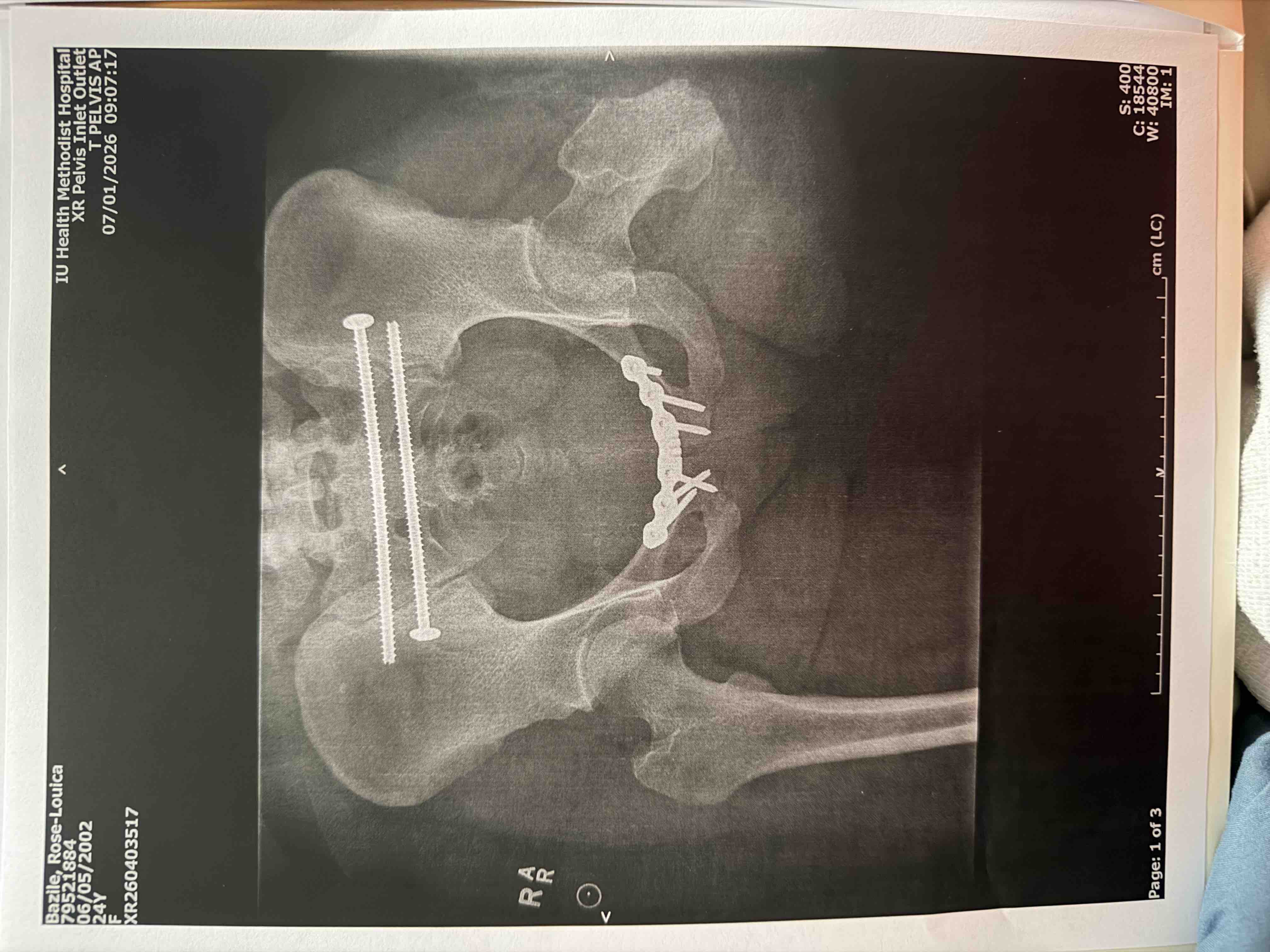 Help me get on my feet after a devastating acciden campaign photo, 7 of 9