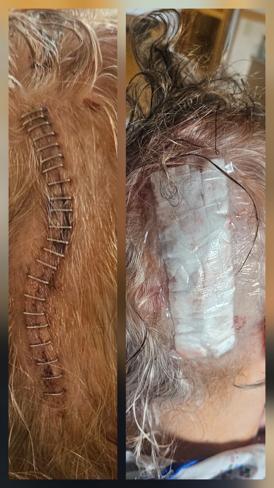 Help Louise Schmidt Fight Metastatic Cancer campaign photo, 2 of 5