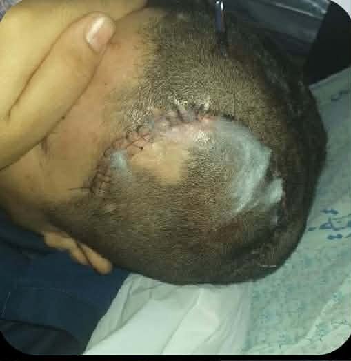 Help Khaled Rebuild His Life After a Devastating Head Injury campaign photo, 2 of 8