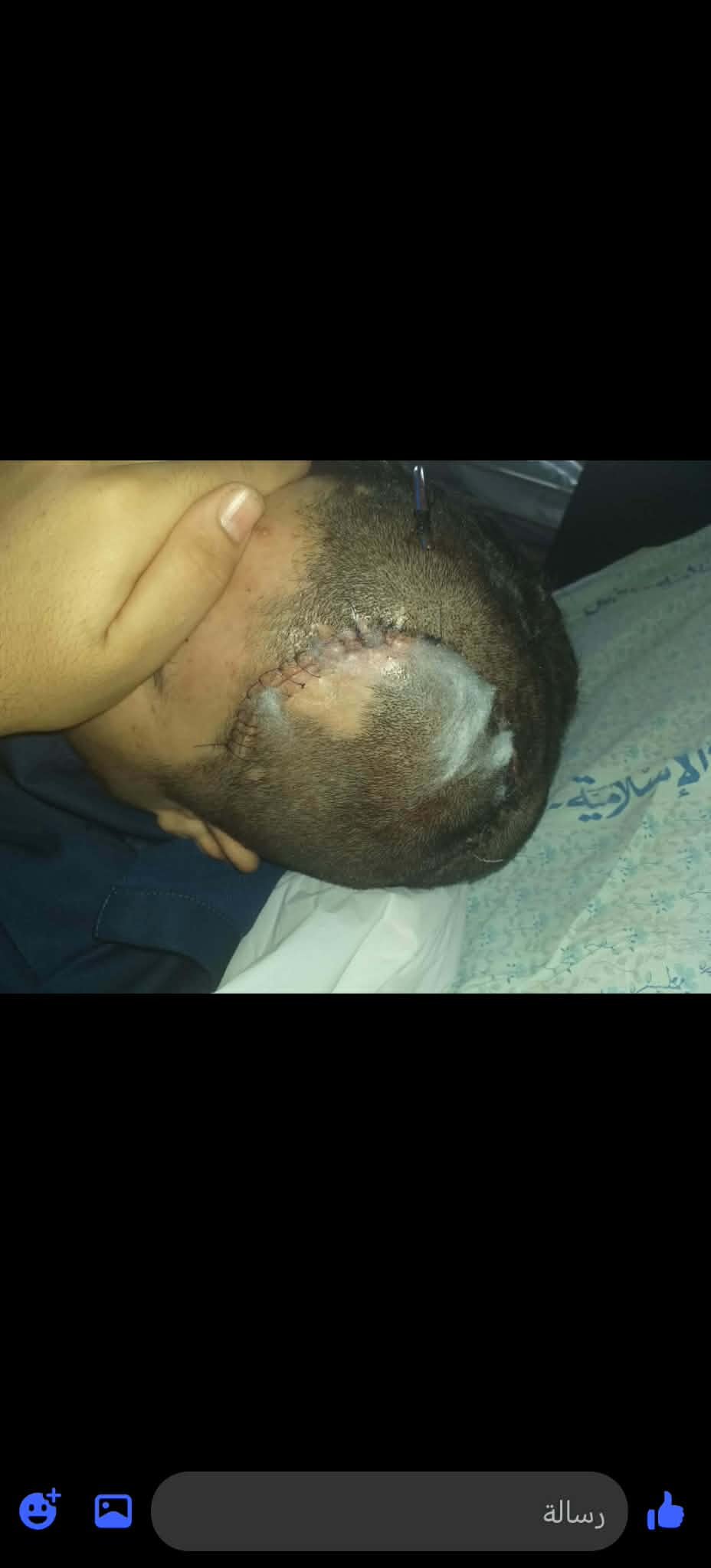 Help Khaled Rebuild His Life After a Devastating Head Injury campaign photo, 5 of 8