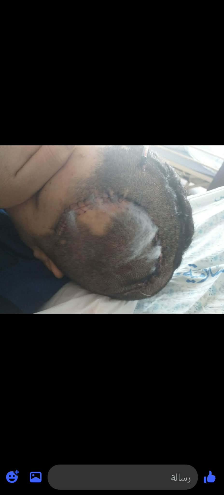 Help Khaled Rebuild His Life After a Devastating Head Injury campaign photo, 6 of 8