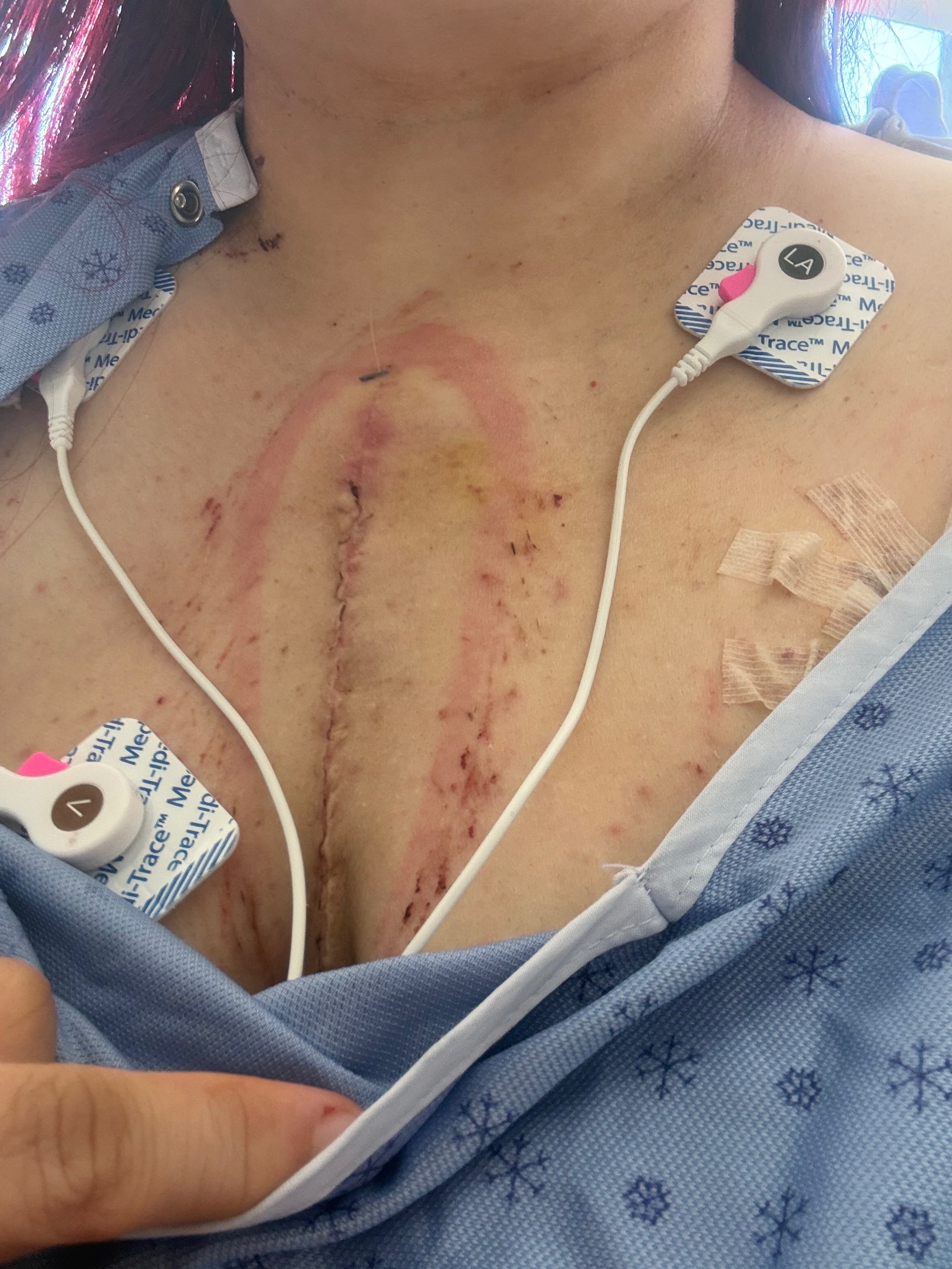 Christina’s Heart Surgery Recovery Fund campaign photo, 6 of 8